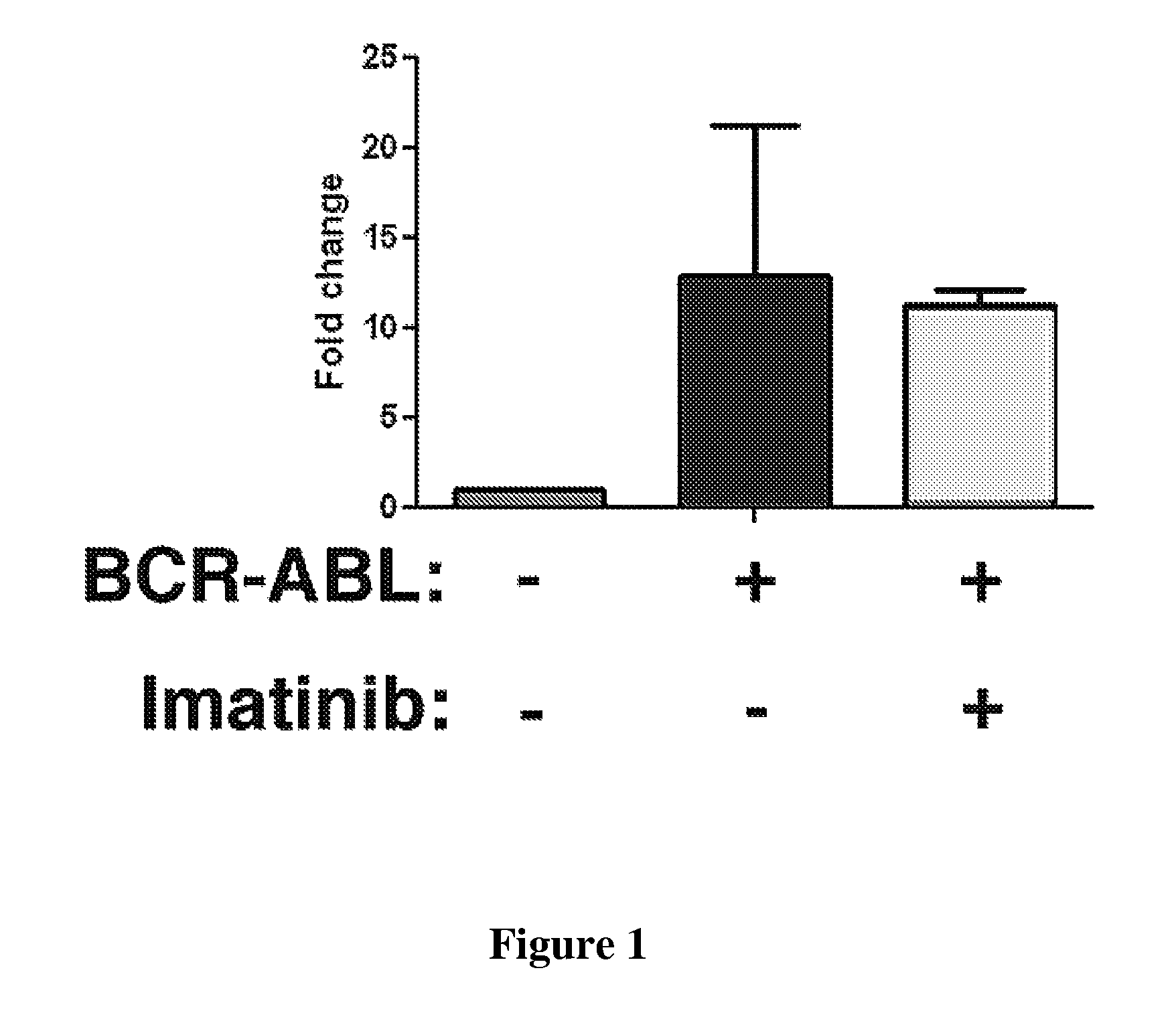 Methods and compositions relating to hematologic malignancies
