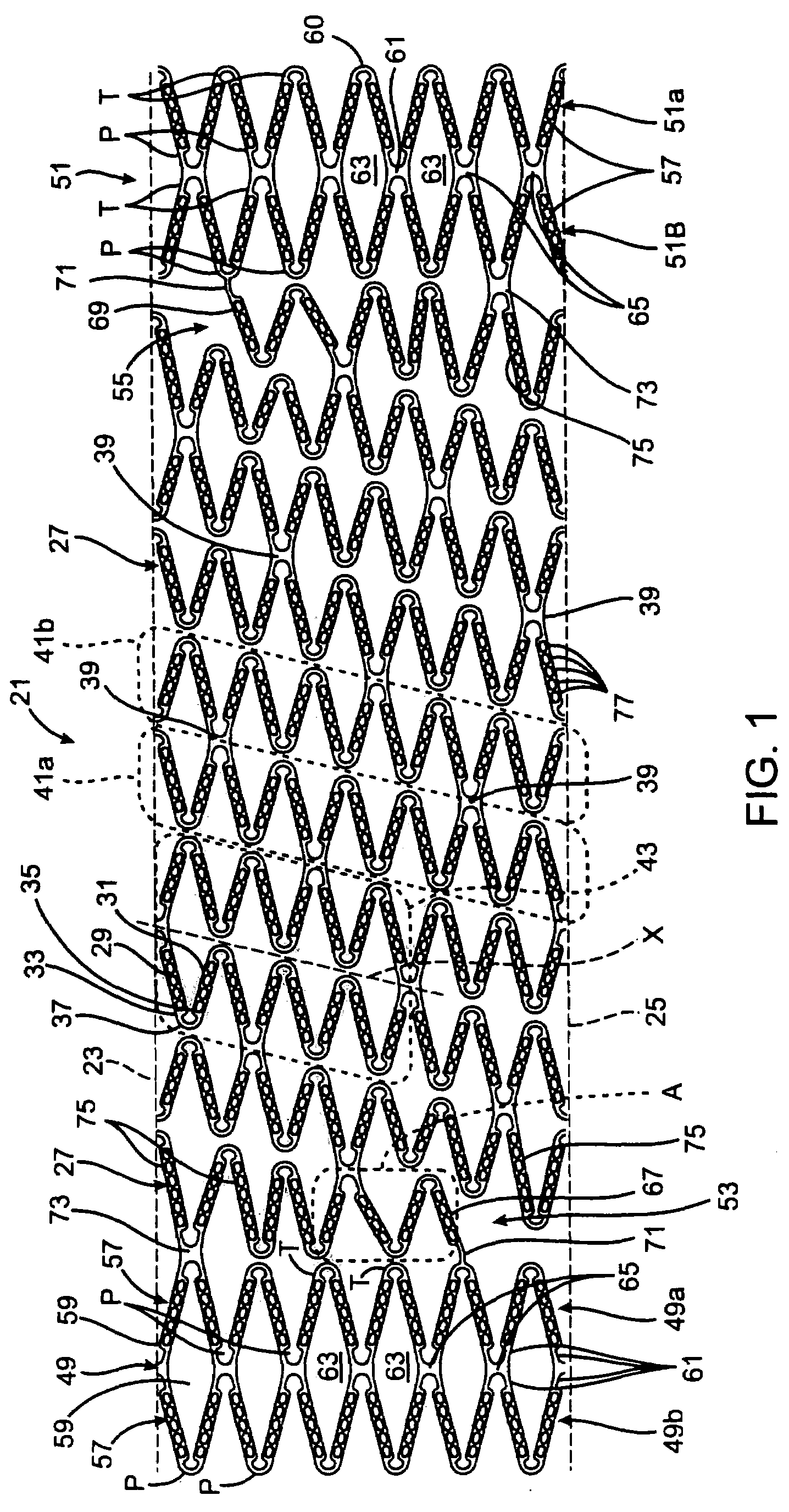 Stent with flexible hinges