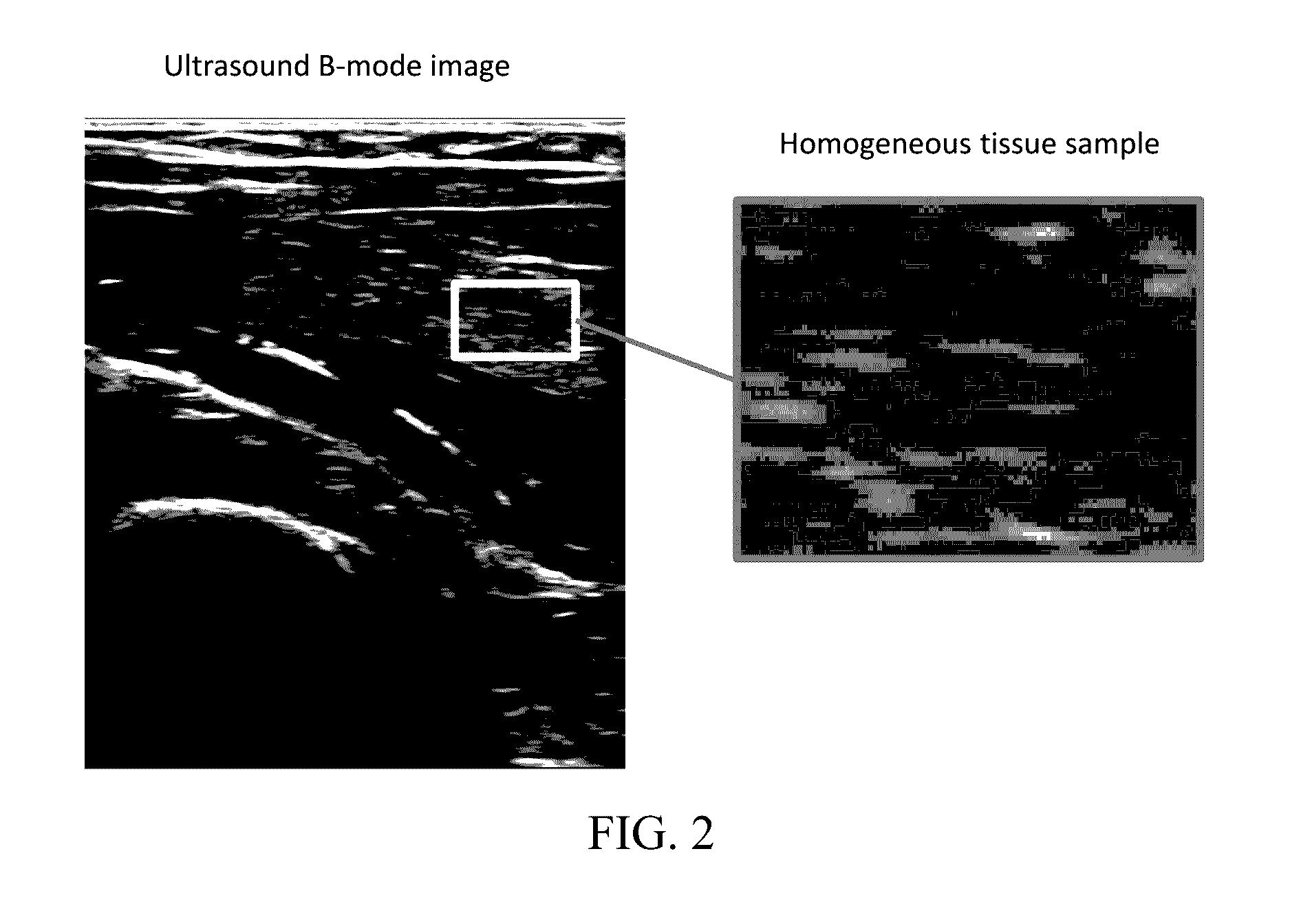 Method and Apparatus For Generating an Ultrasound Scatterer Representation