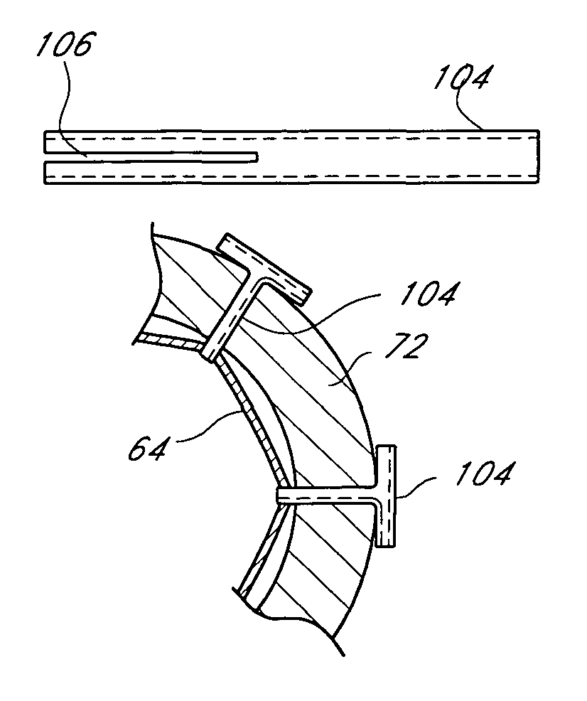 Catheter-based tissue remodeling devices and methods