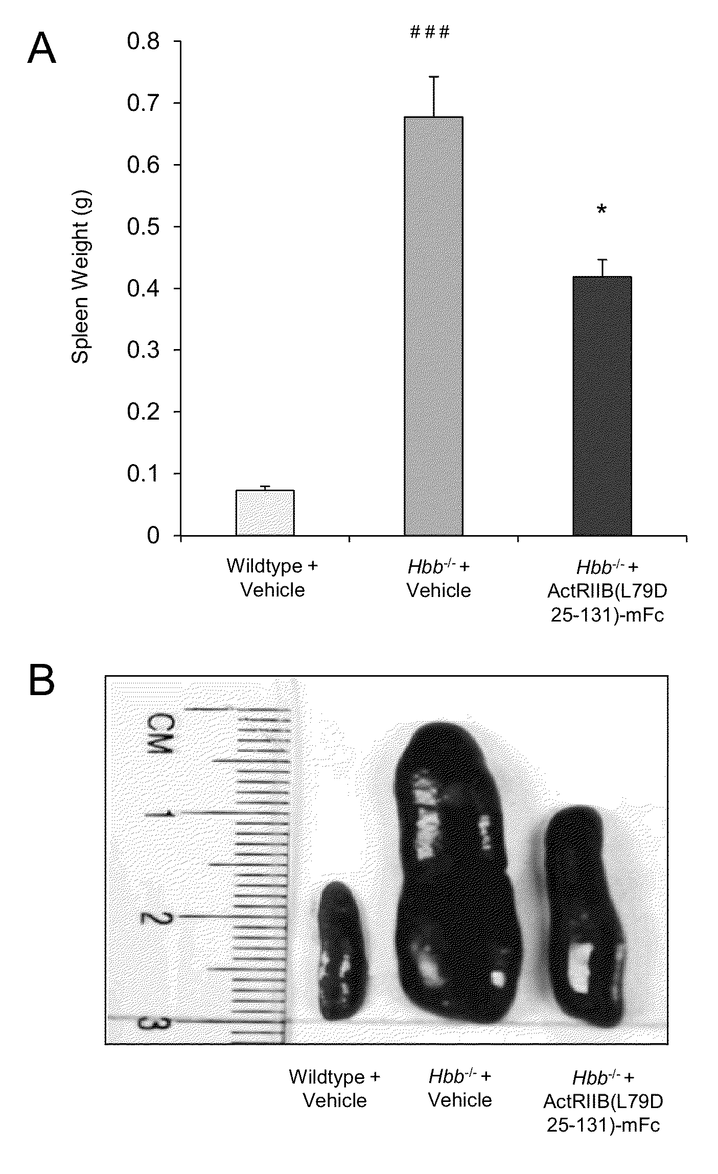 Methods and compositions for treating ineffective erythropoiesis