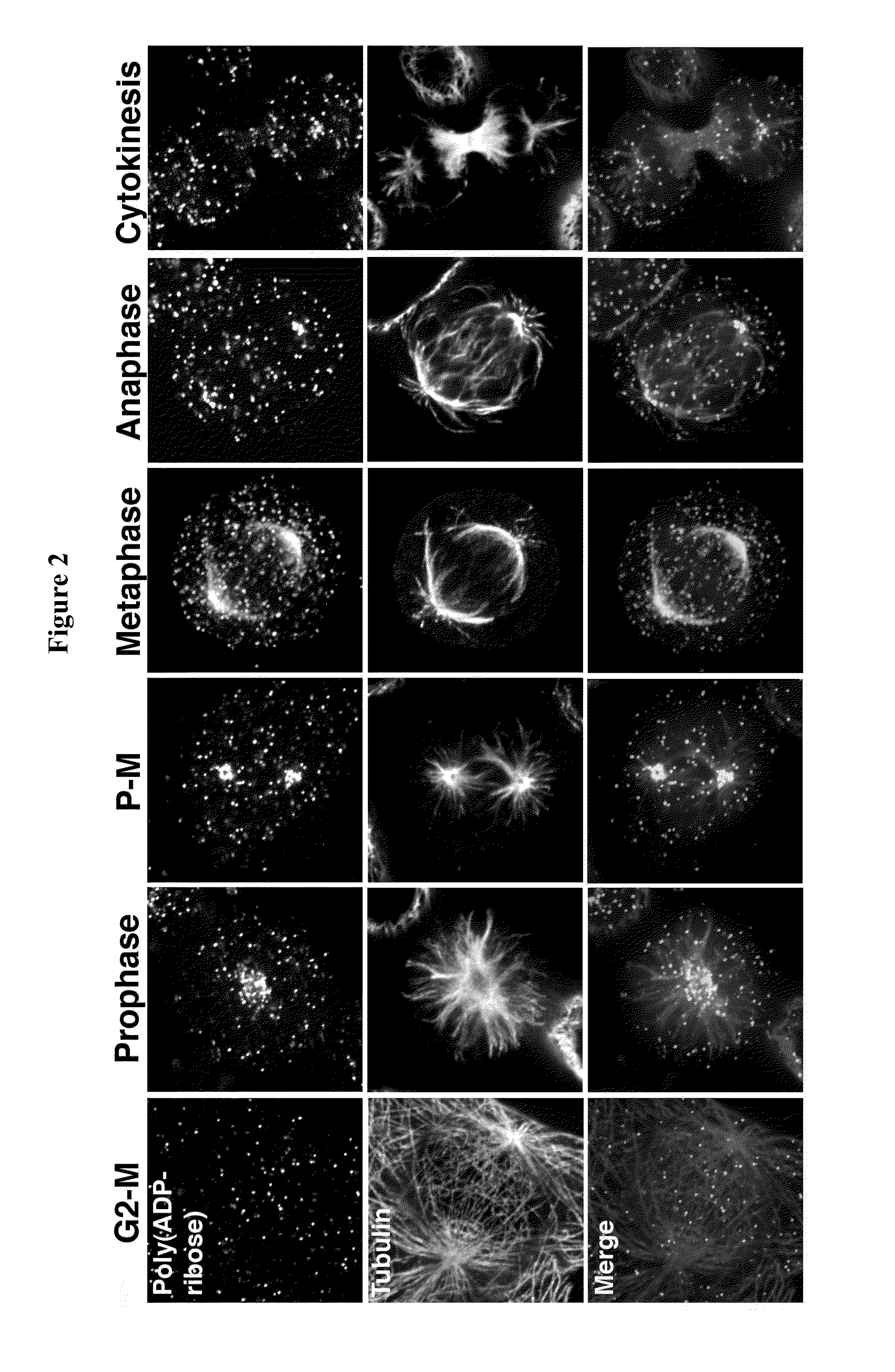 Compositions and methods for treating cancer and modulating stress granule formation