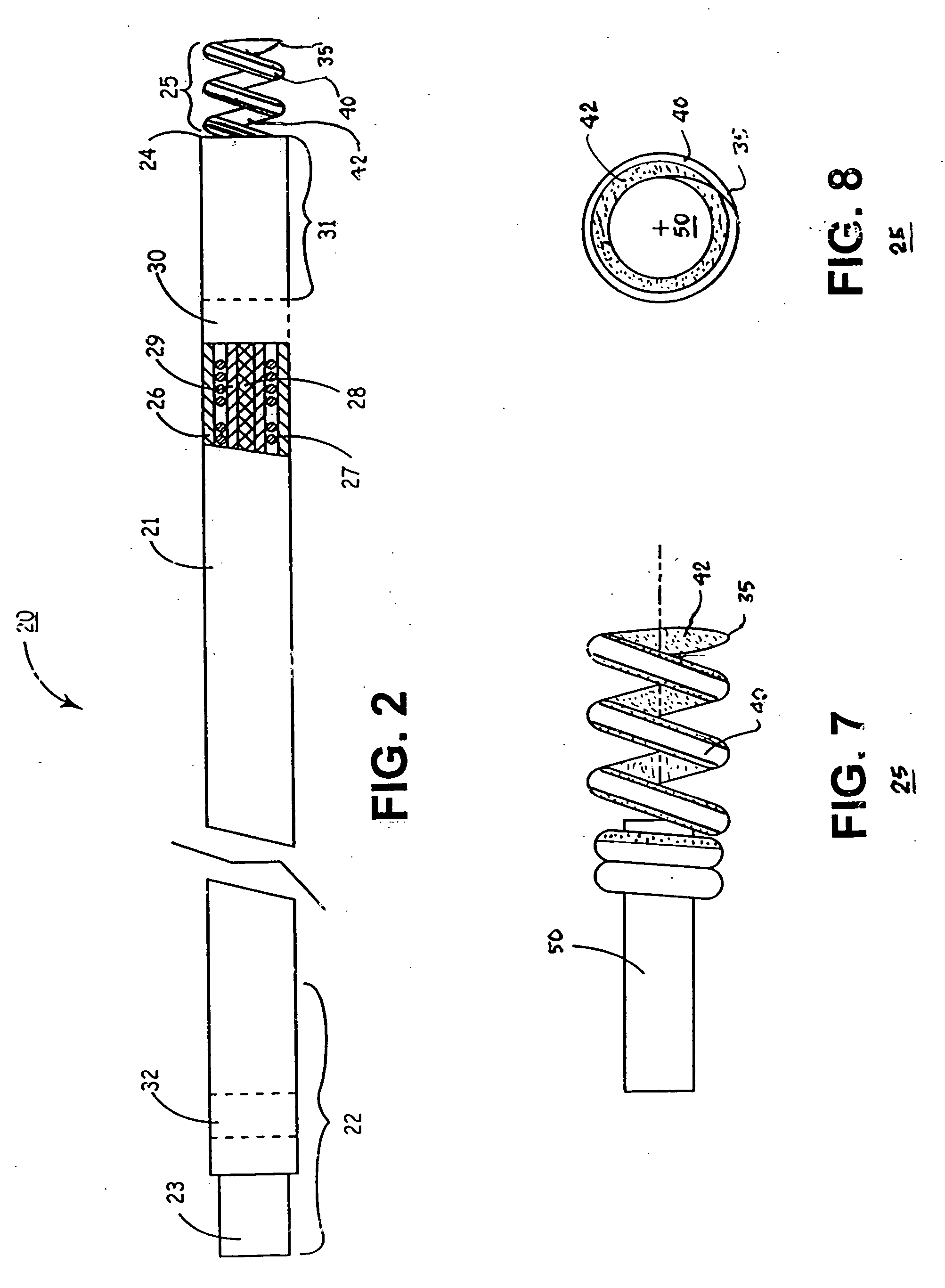 High impedance active fixation electrode of an electrical medical lead