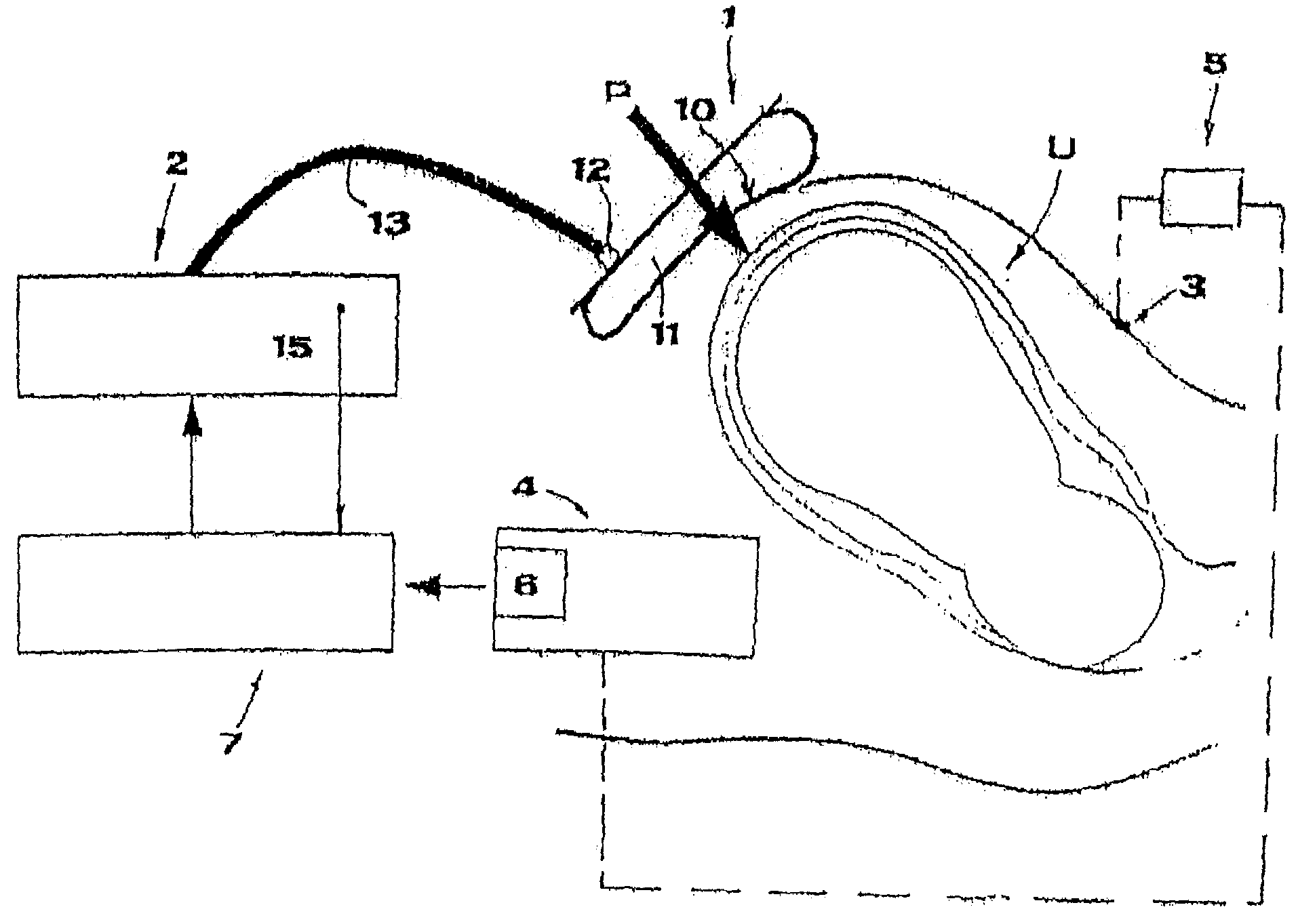 Automatic apparatus for controlling the childbirth labor