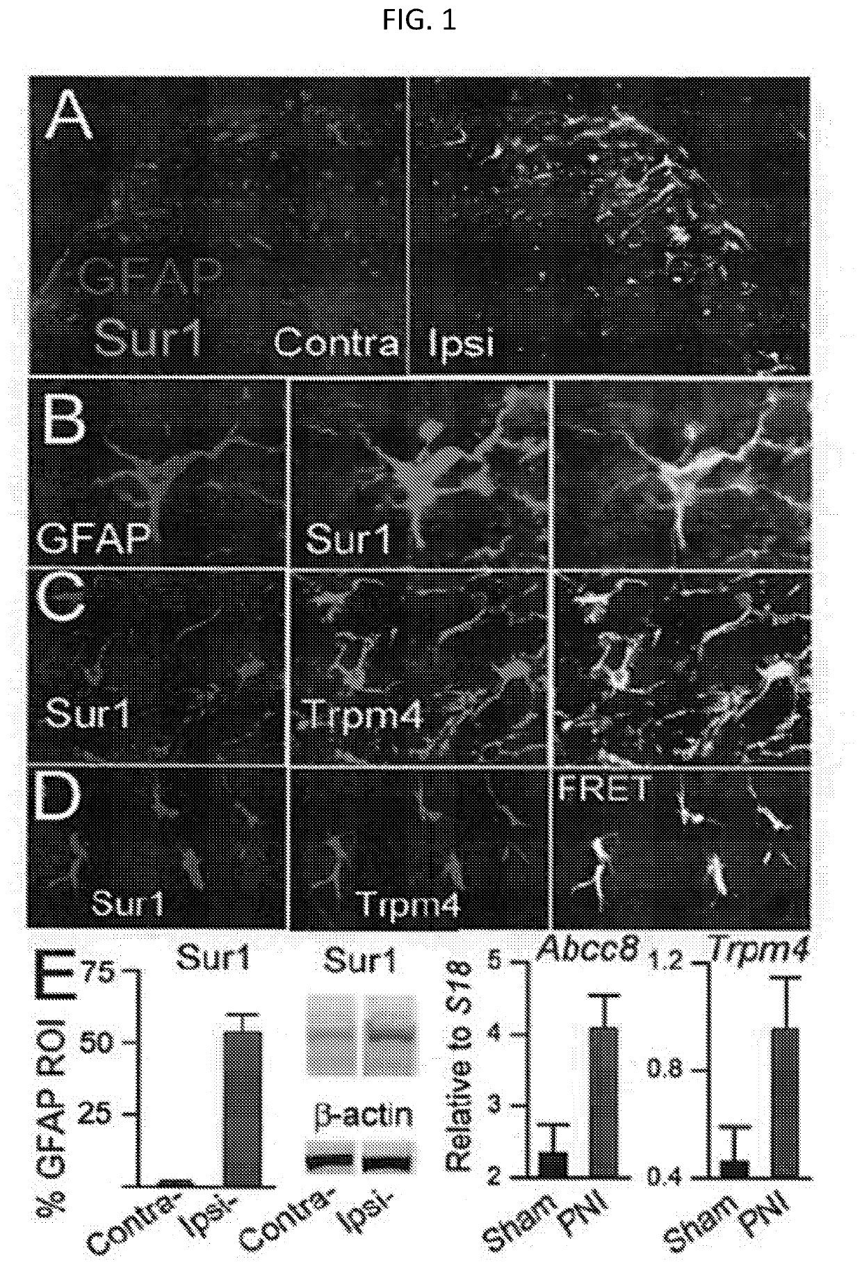 Compositions and methods for treating pain