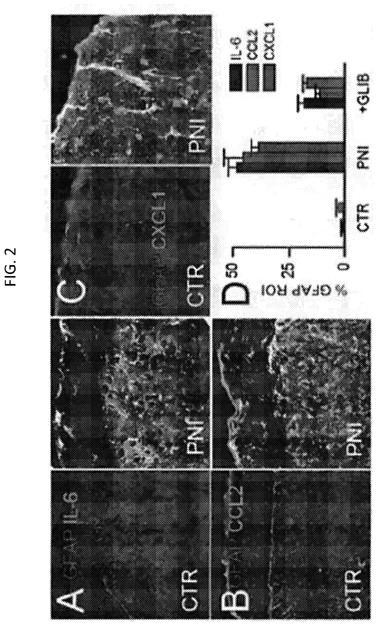 Compositions and methods for treating pain