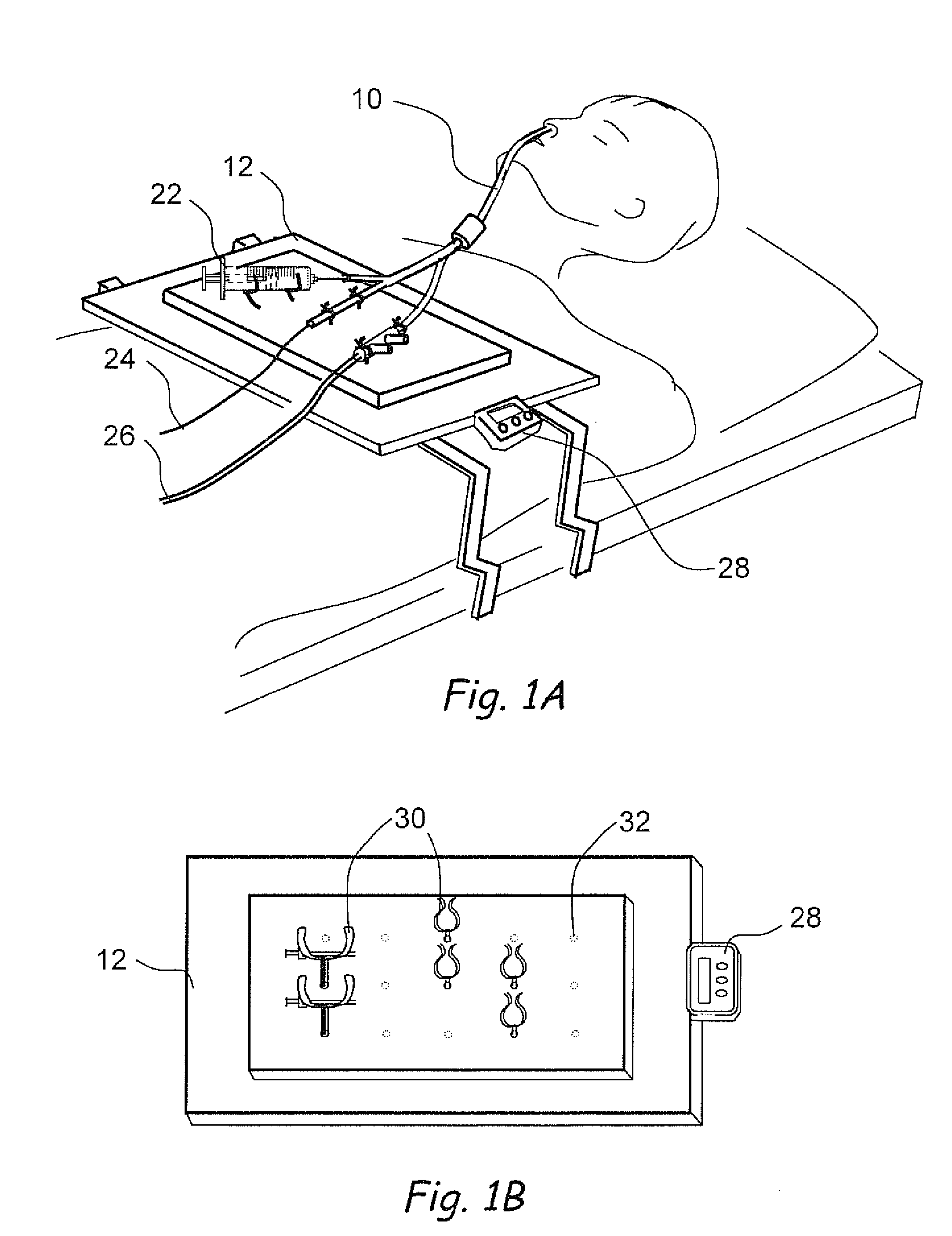 Devices, Systems and Methods for Treating Disorders of the Ear, Nose and Throat