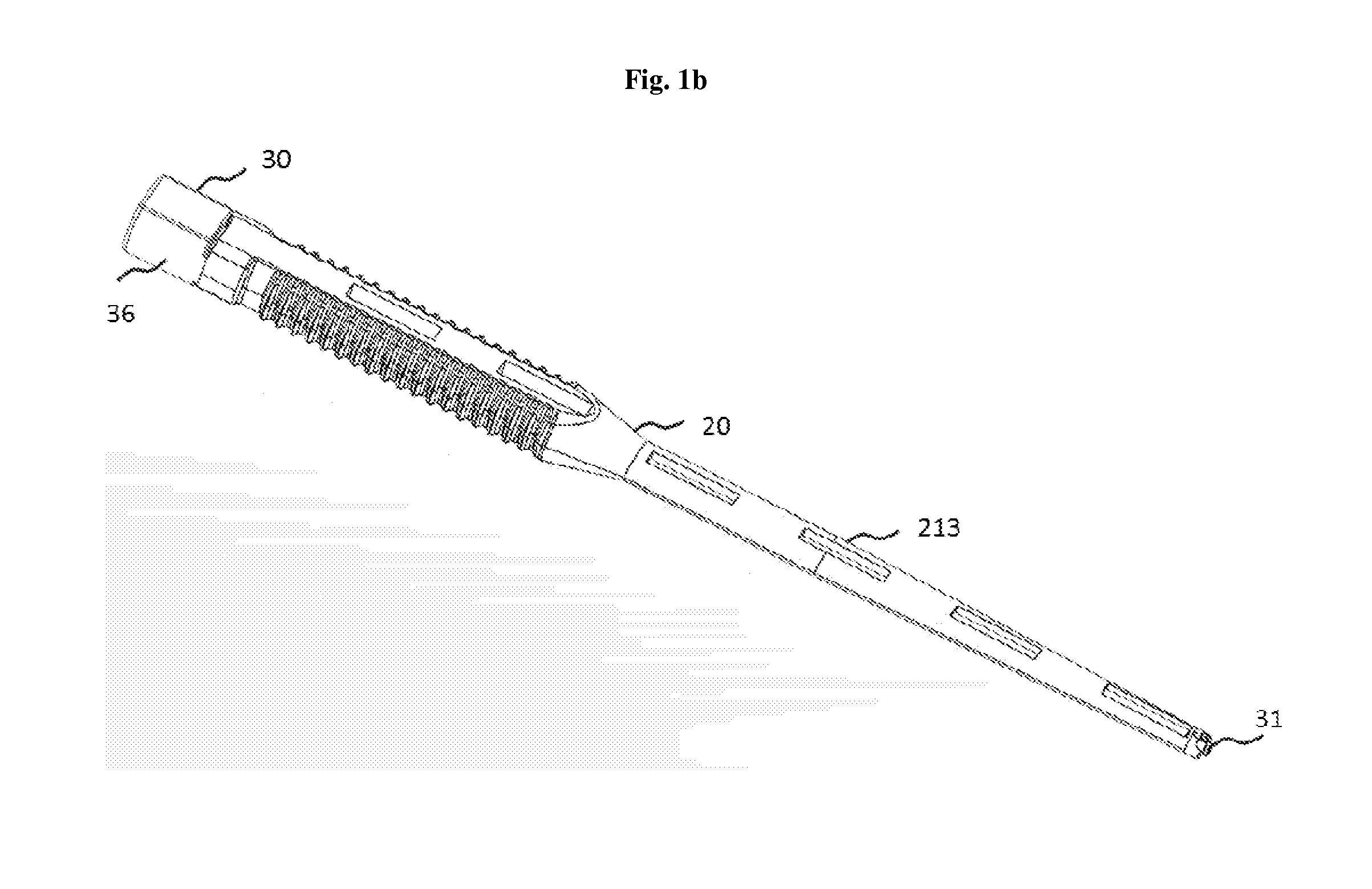 Lock and release implant delivery system