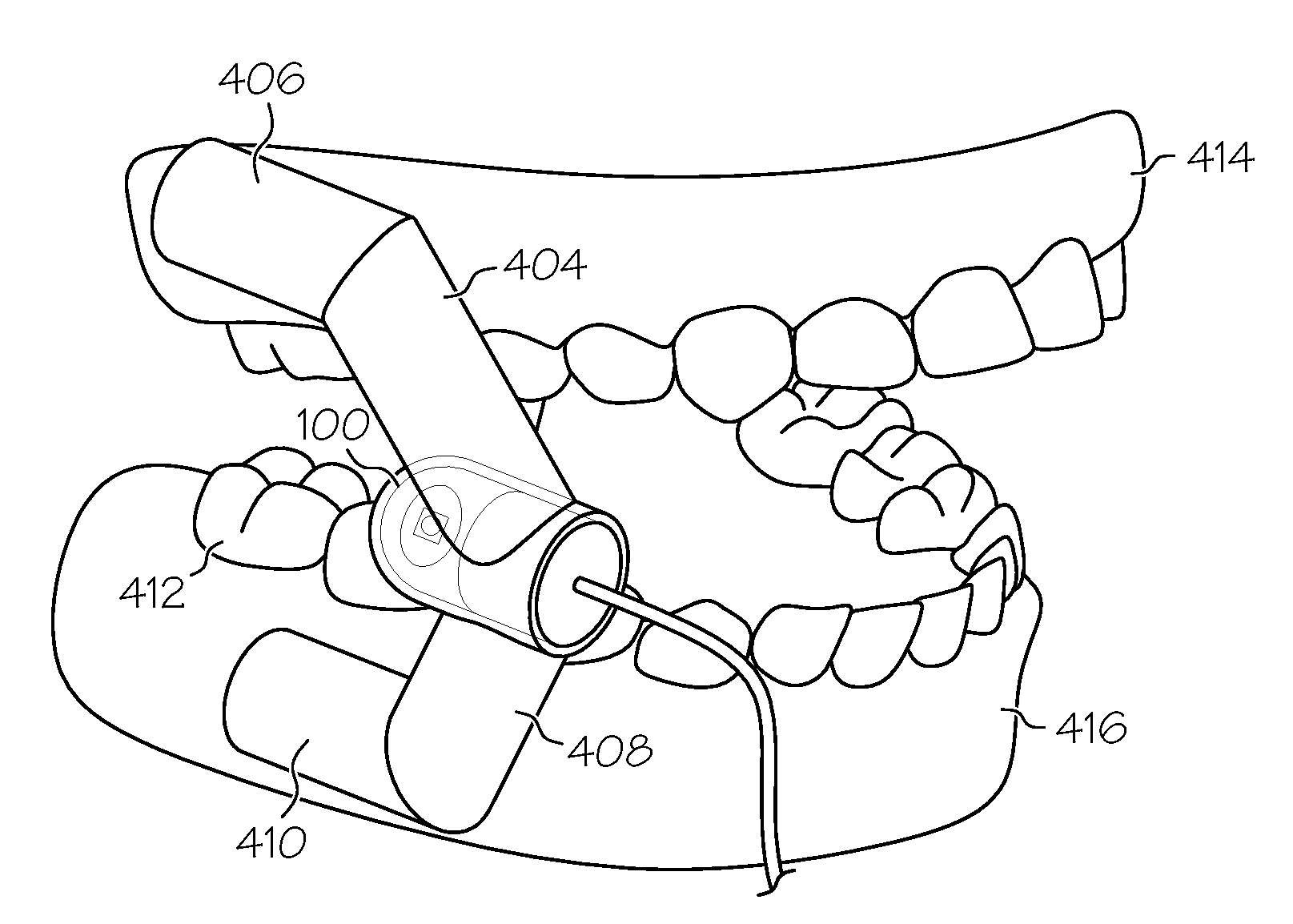 System and method to improve mouth disease diagnosis