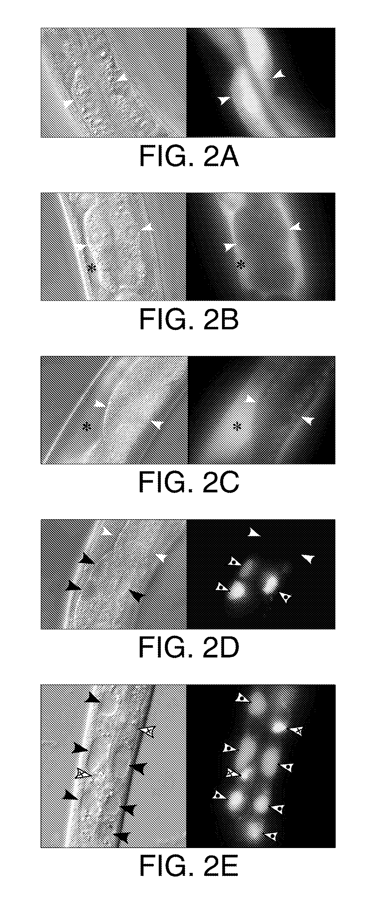 Methods of Treating Disorders Associated with Protein Aggregation