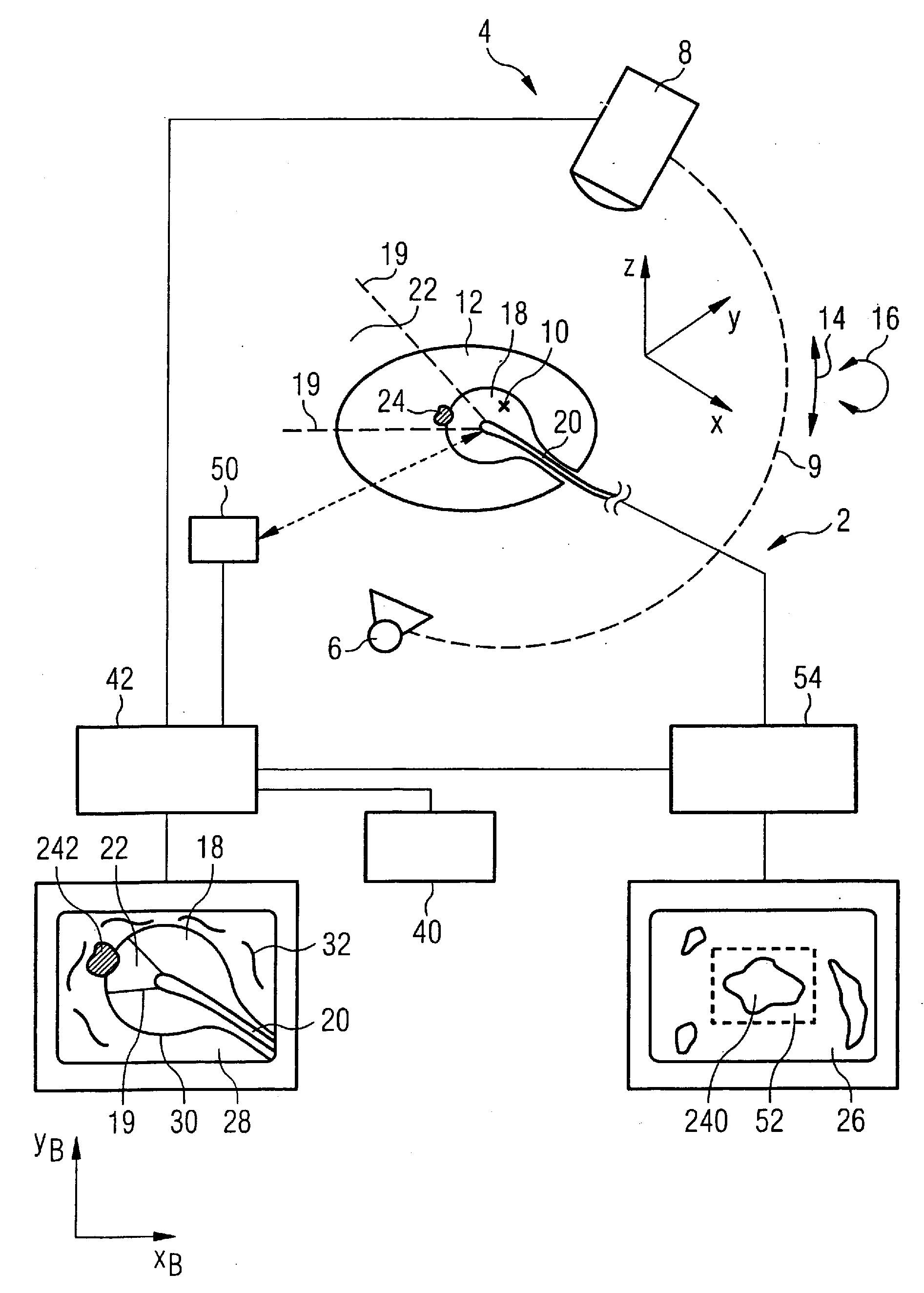 Imaging method for medical diagnostics and device operating according to this method