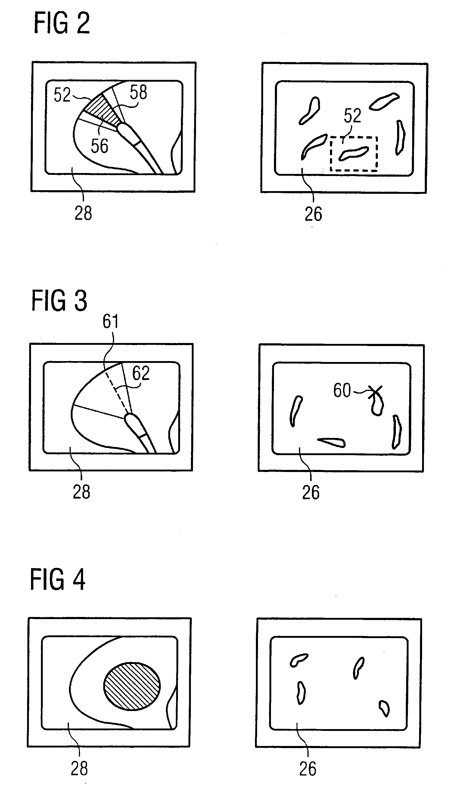 Imaging method for medical diagnostics and device operating according to this method