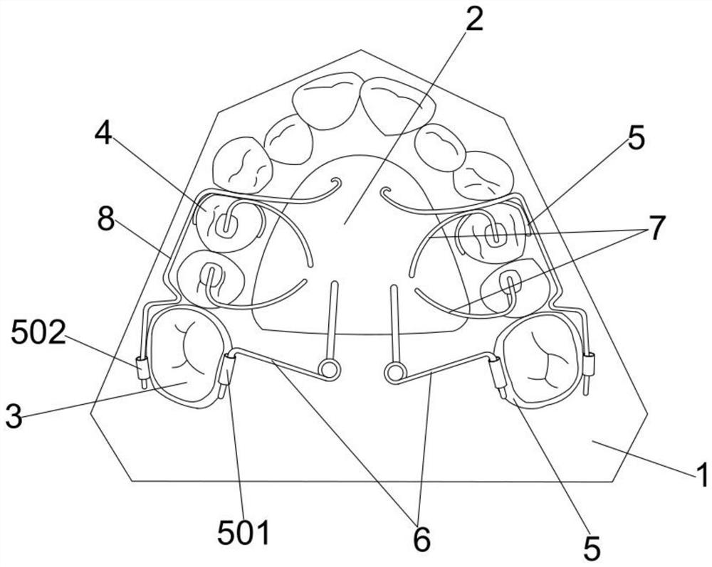 Bilateral molar pushing oral appliance