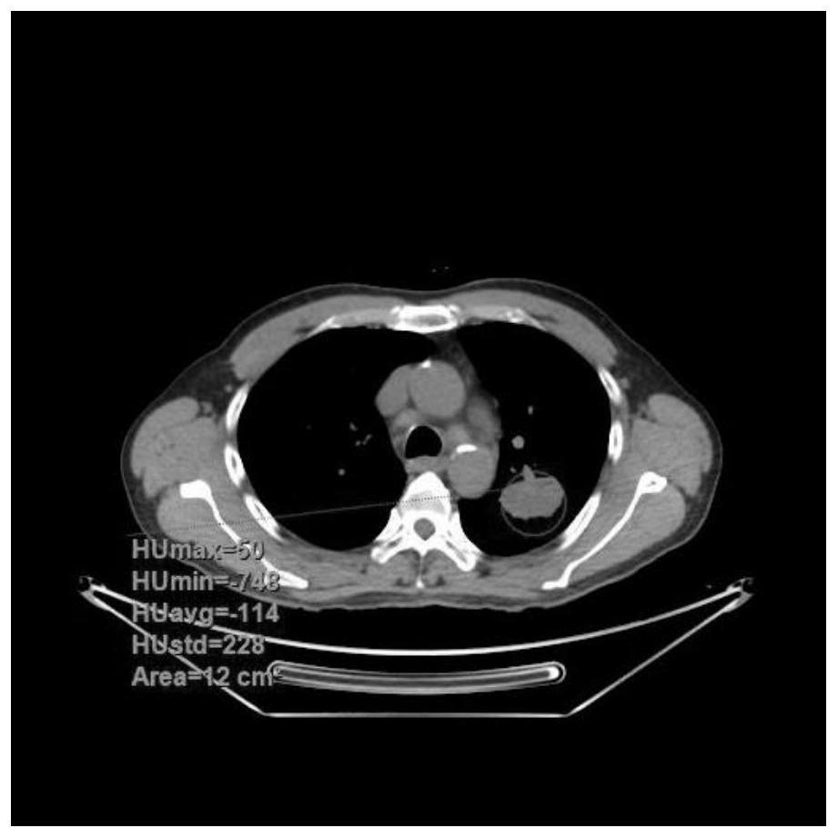 An annotation extraction method for medical imaging lesions that can improve doctor efficiency