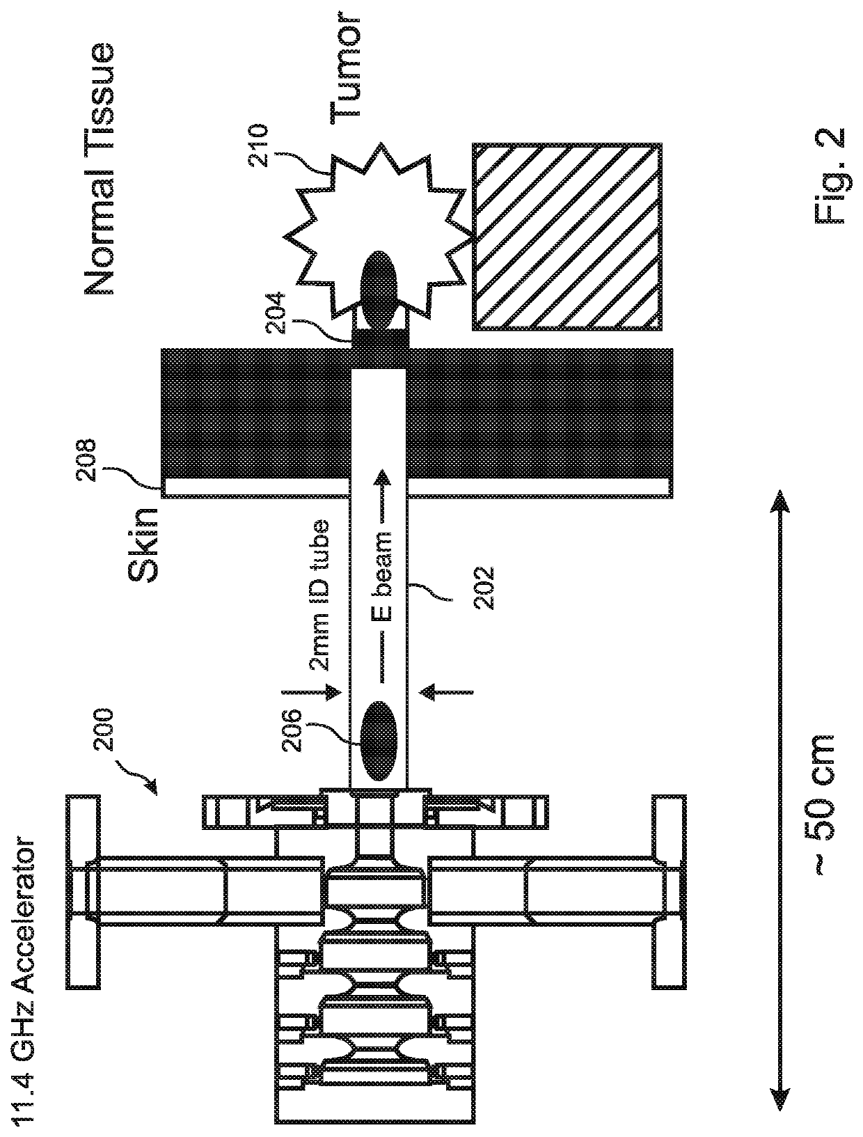 High brightness electron beam based precise radiation therapy method and system