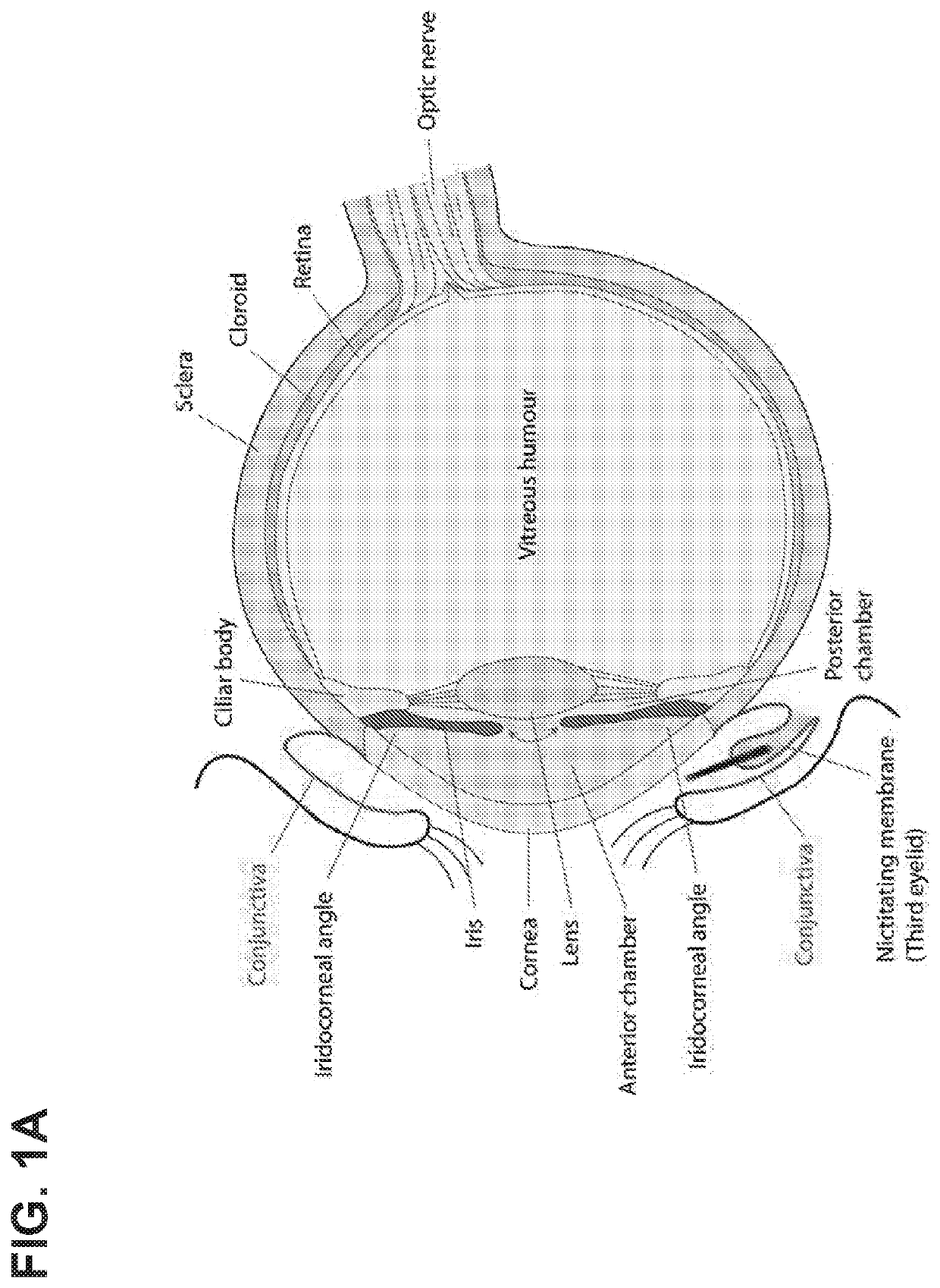 Glaucoma Treatment Via Intracameral Ocular Implants