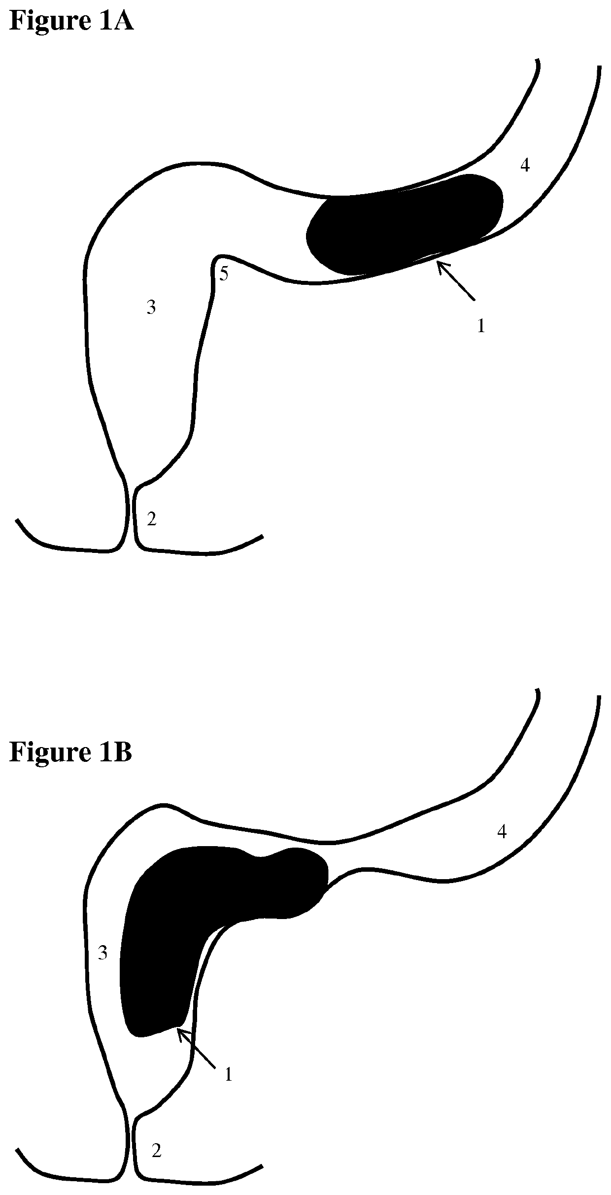 Apparatus for testing distal colonic and anorectal function