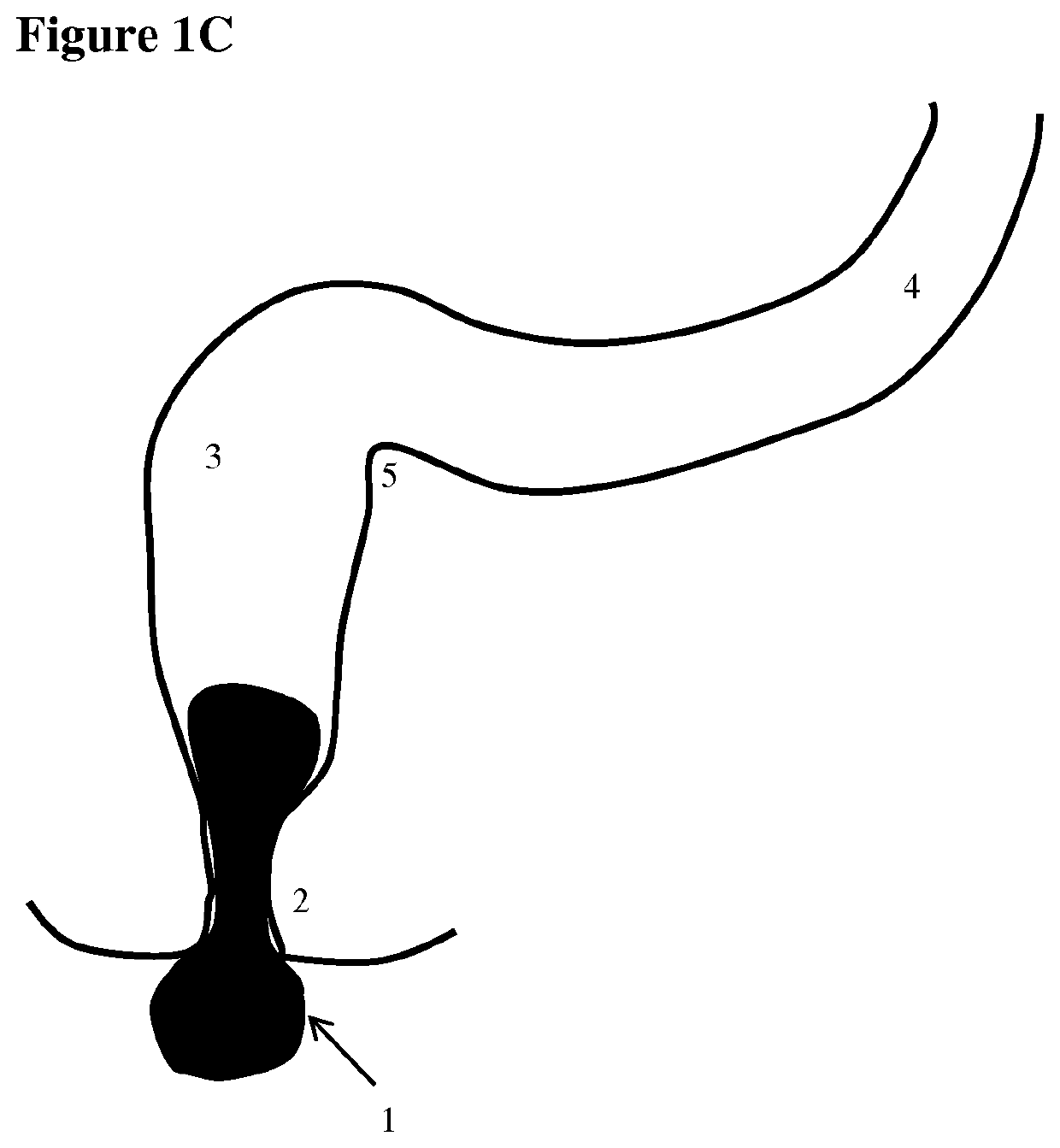 Apparatus for testing distal colonic and anorectal function