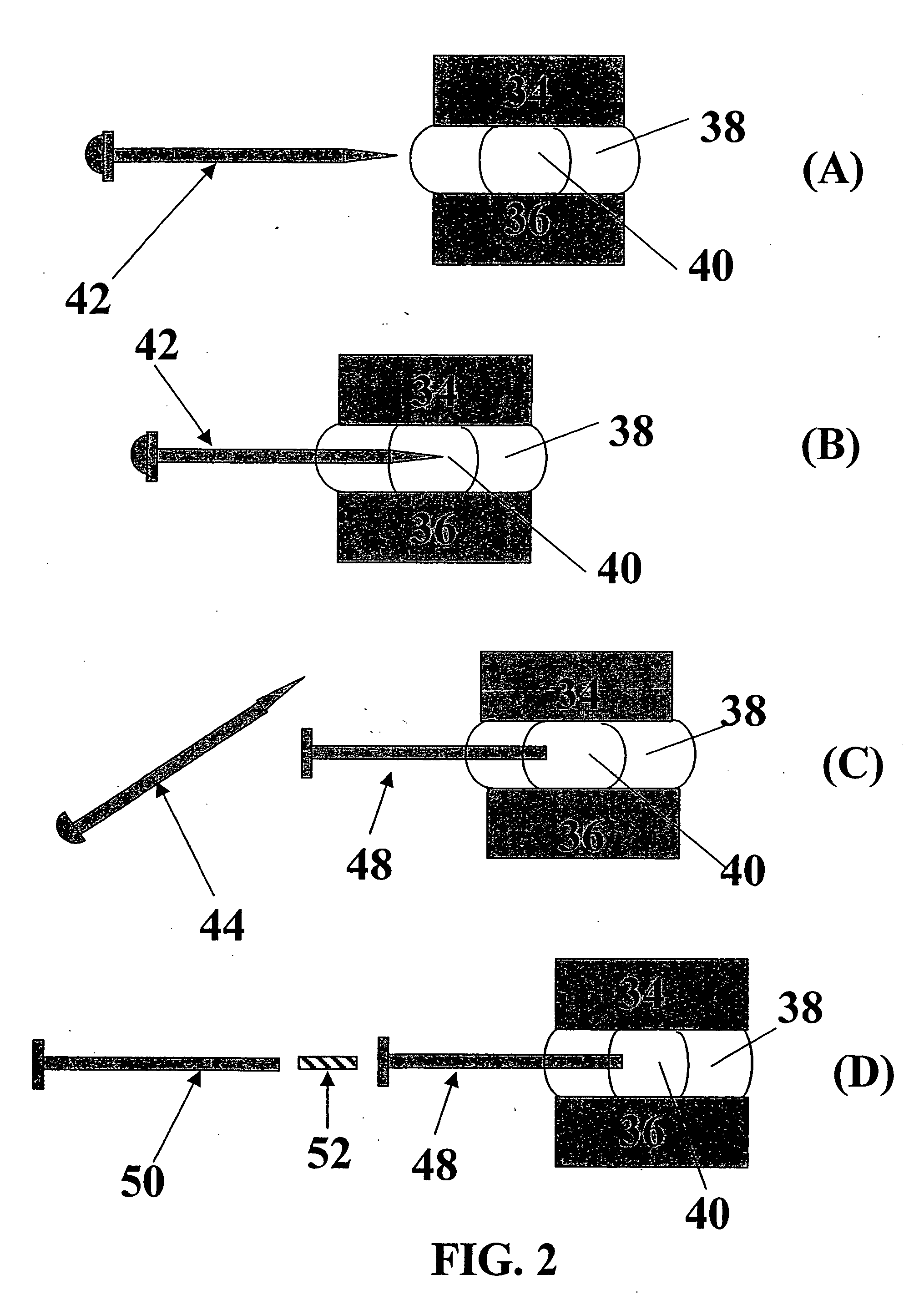 Implants for treatment of symptomatic or degenerated intervertebral discs