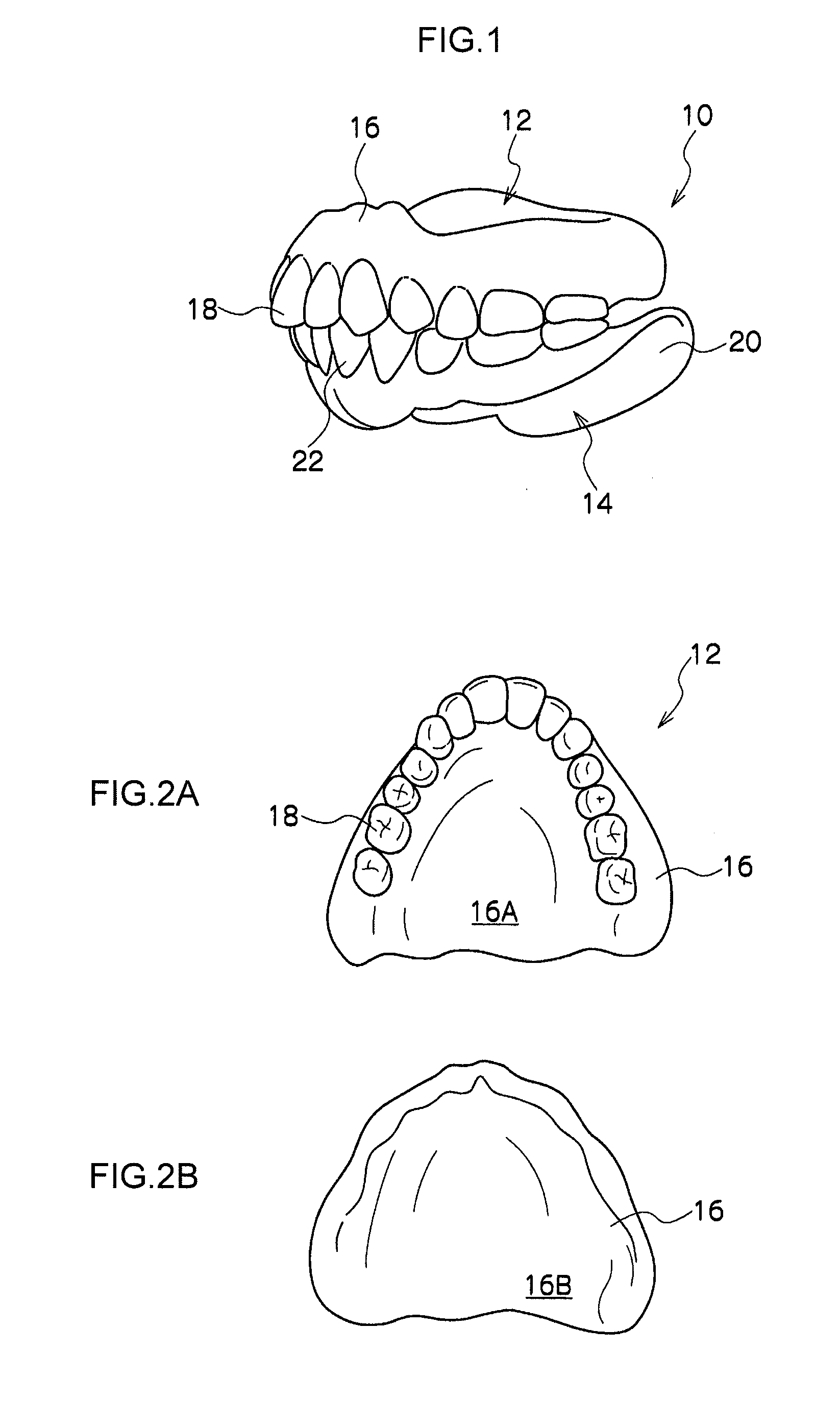 Removable denture and method of producing the same