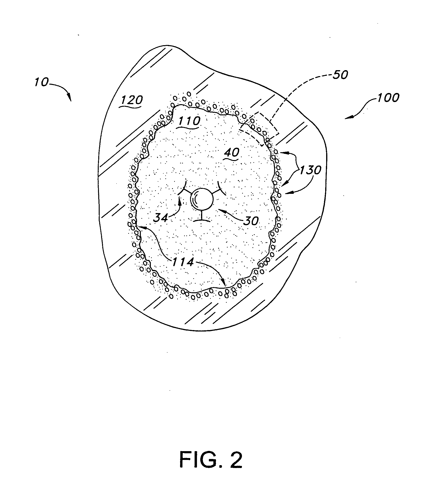 Method and apparatus for strengthening the biomechanical properties of implants