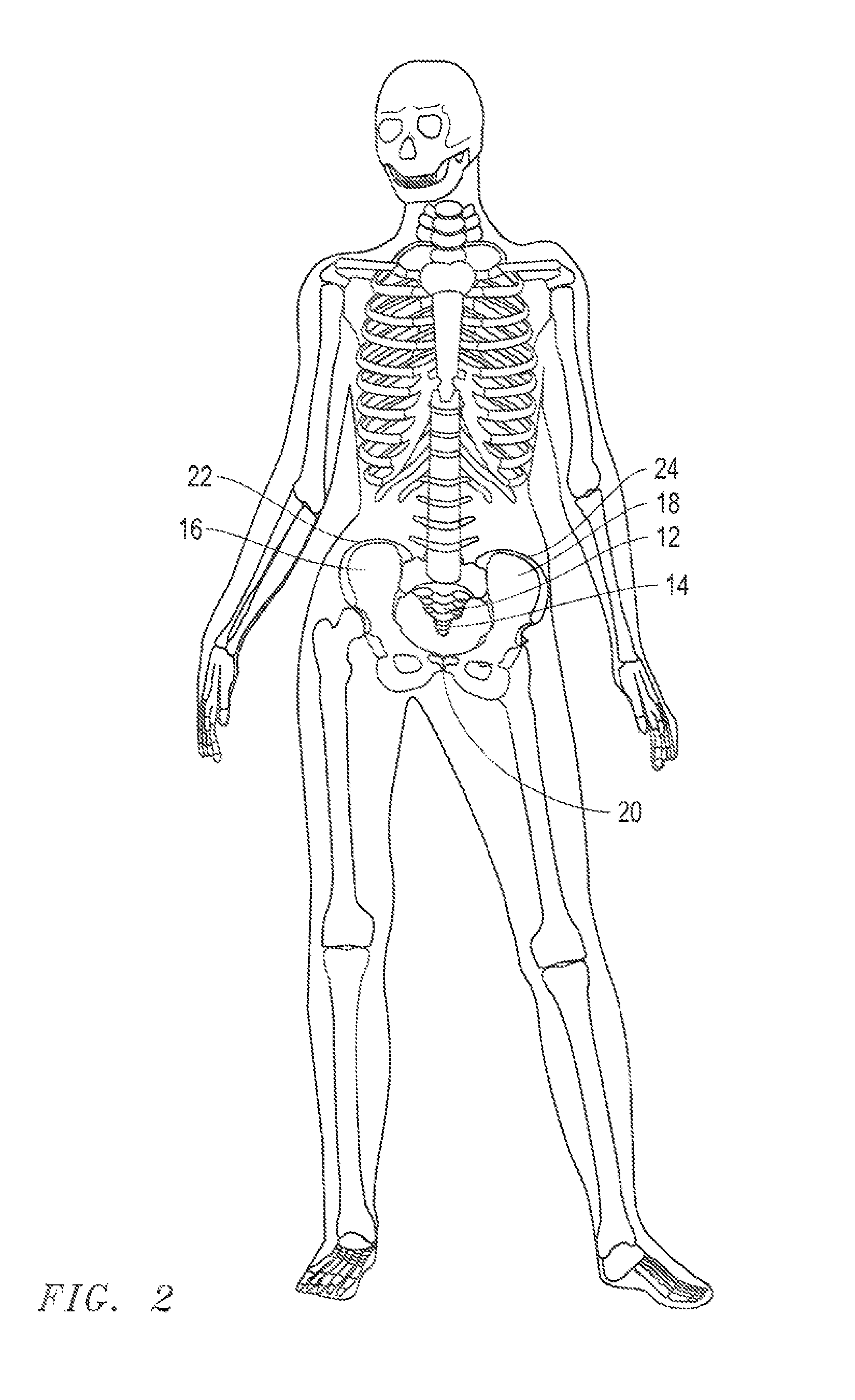 Adjustable pelvic compression belt and methods for reducing the width of a user's hips