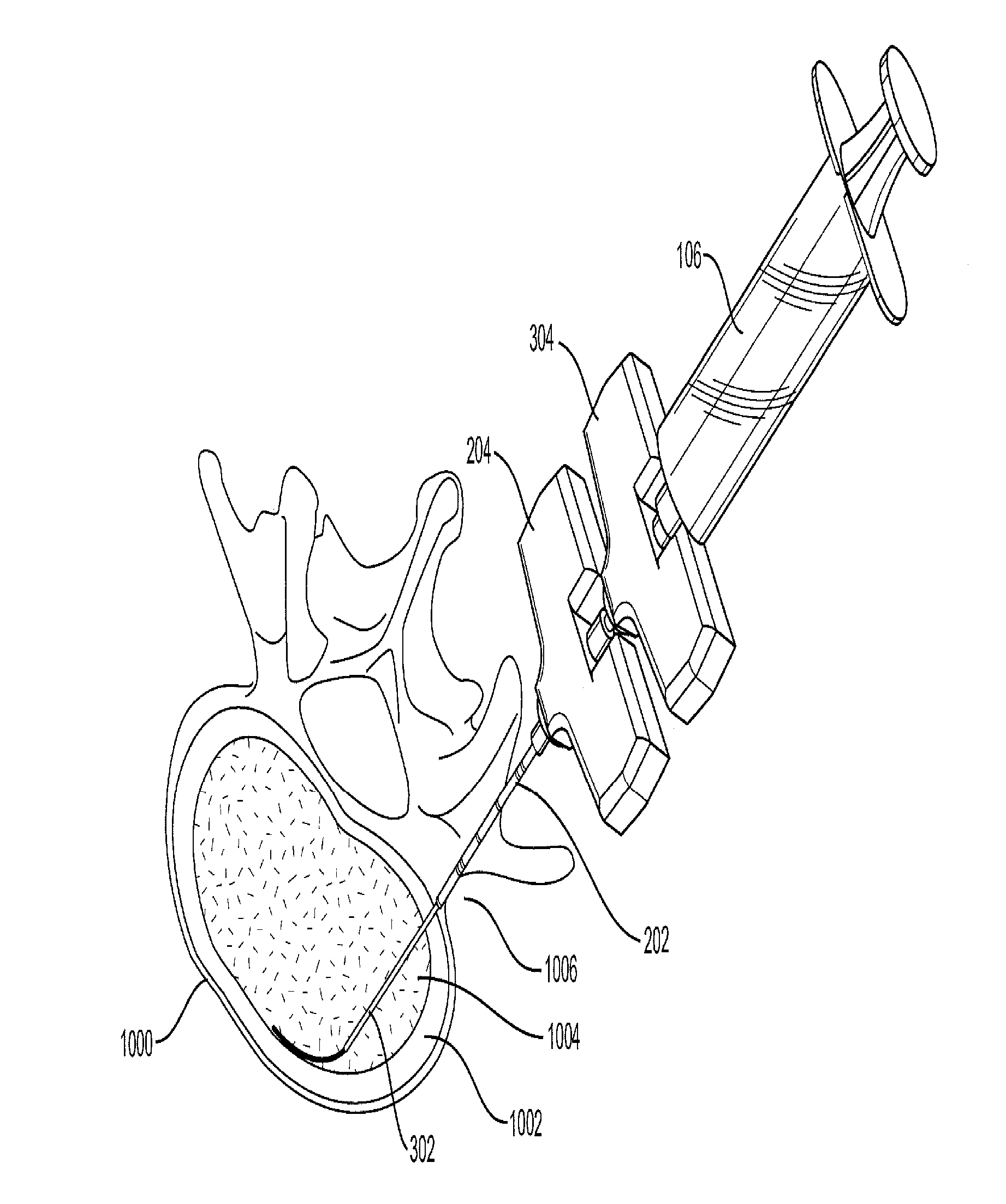 Apparatus and Methods for Aspirating Tissue
