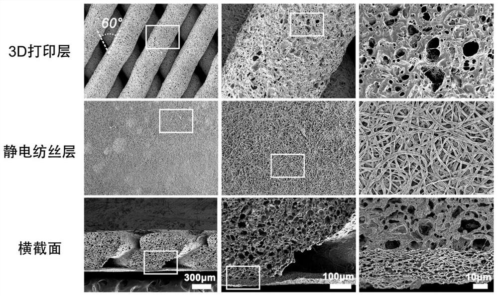 Preparation method of 3D printing moldable guided bone regeneration membrane