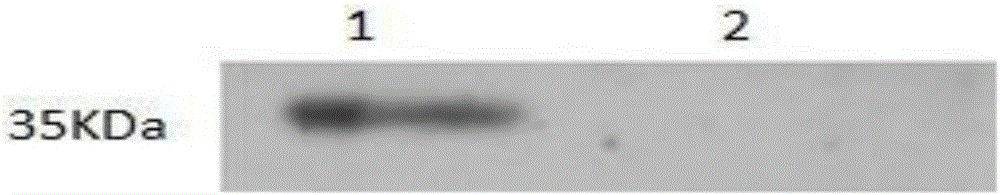 B cell antigen epitope polypeptide of infectious bronchitis virus isolate S1 protein, and vaccine thereof