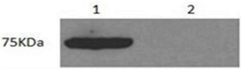 B cell antigen epitope polypeptide of infectious bronchitis virus isolate S1 protein, and vaccine thereof