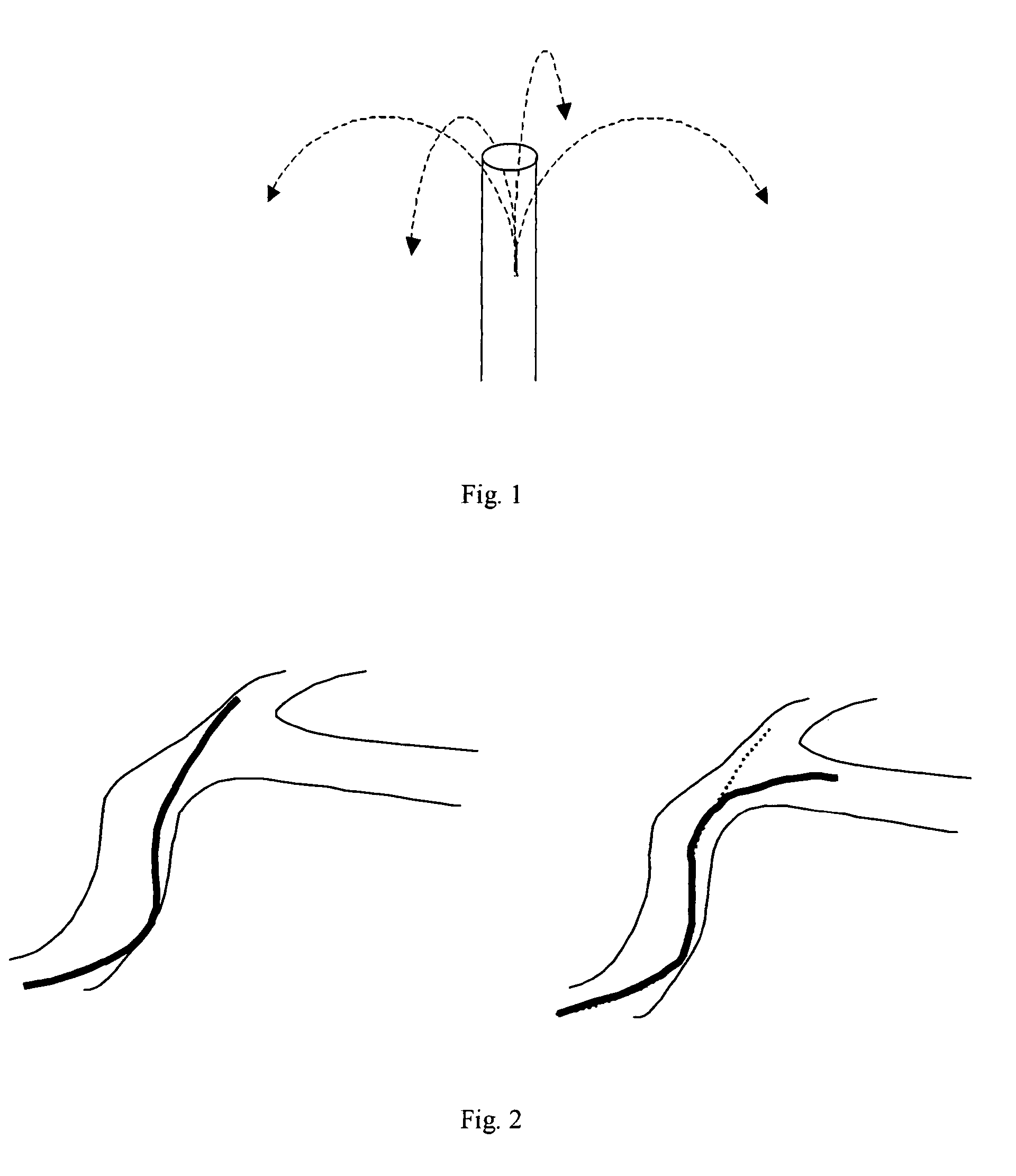 Medical device guiding system