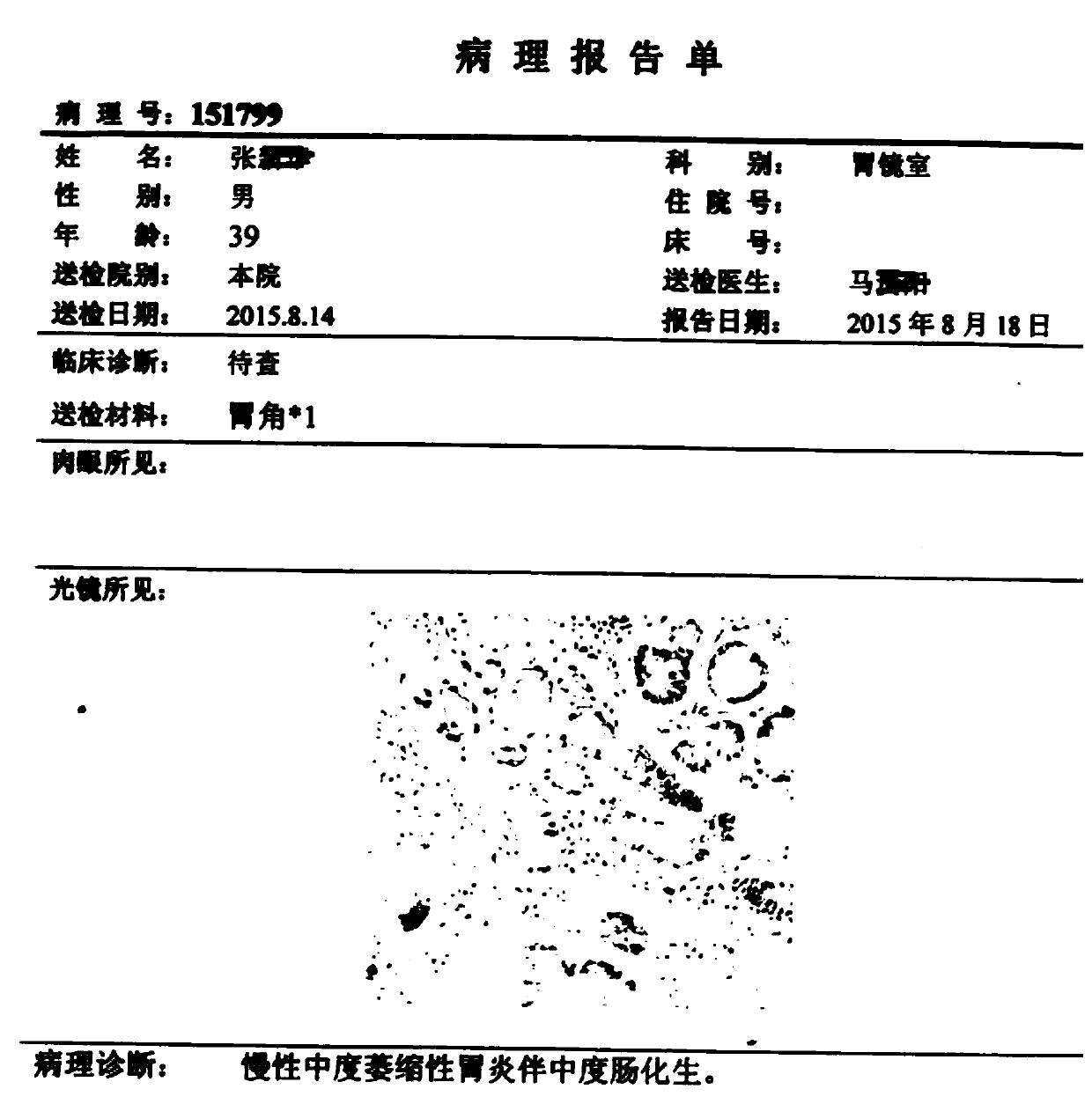 Traditional Chinese medicine compound composition for treating chronic atrophic gastritis and gastric precancerous lesions and application thereof