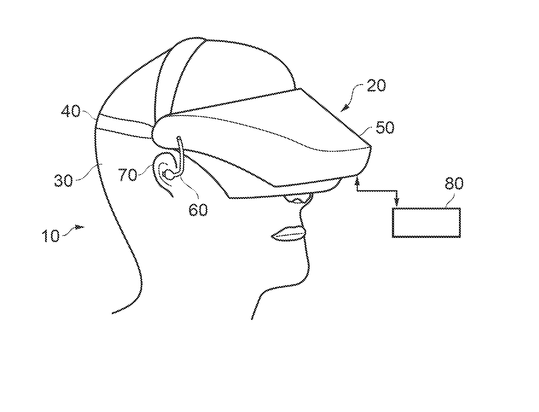 Head mountable display
