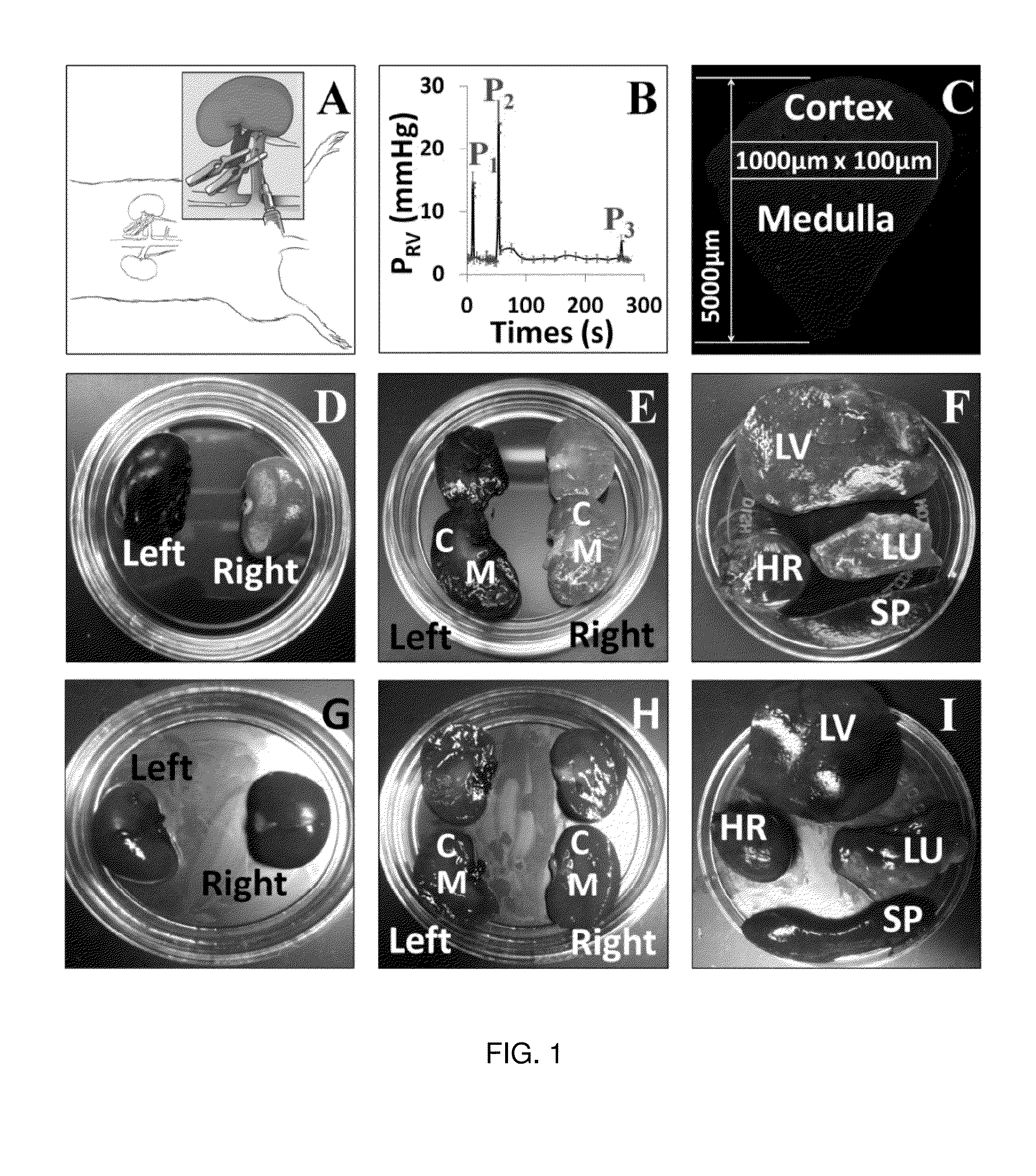 Hydrodynamic method and apparatus for delivering fluids to kidney tissues