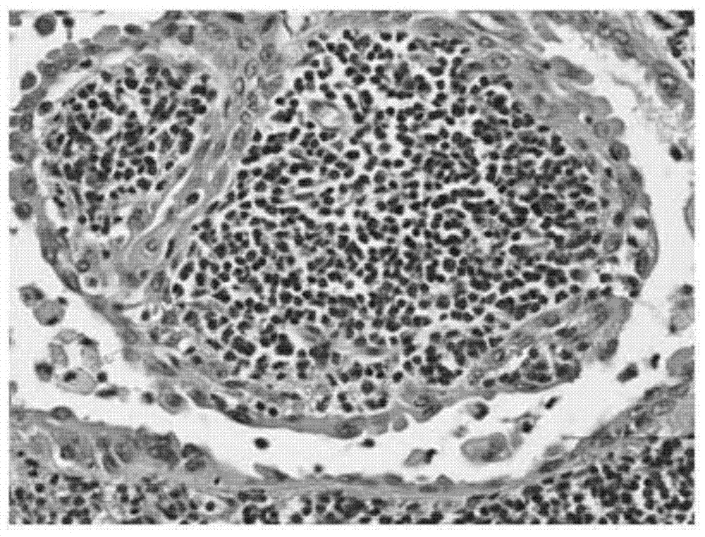 A kind of eosin staining liquid and he staining liquid containing eosin staining liquid