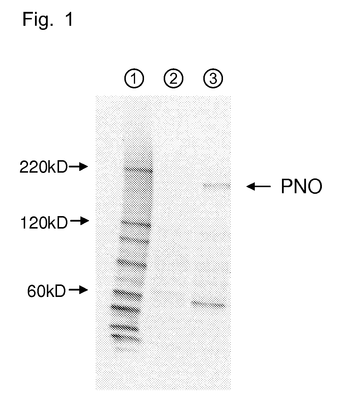 Amino acid producing microorganism and a method for producing an amino acid