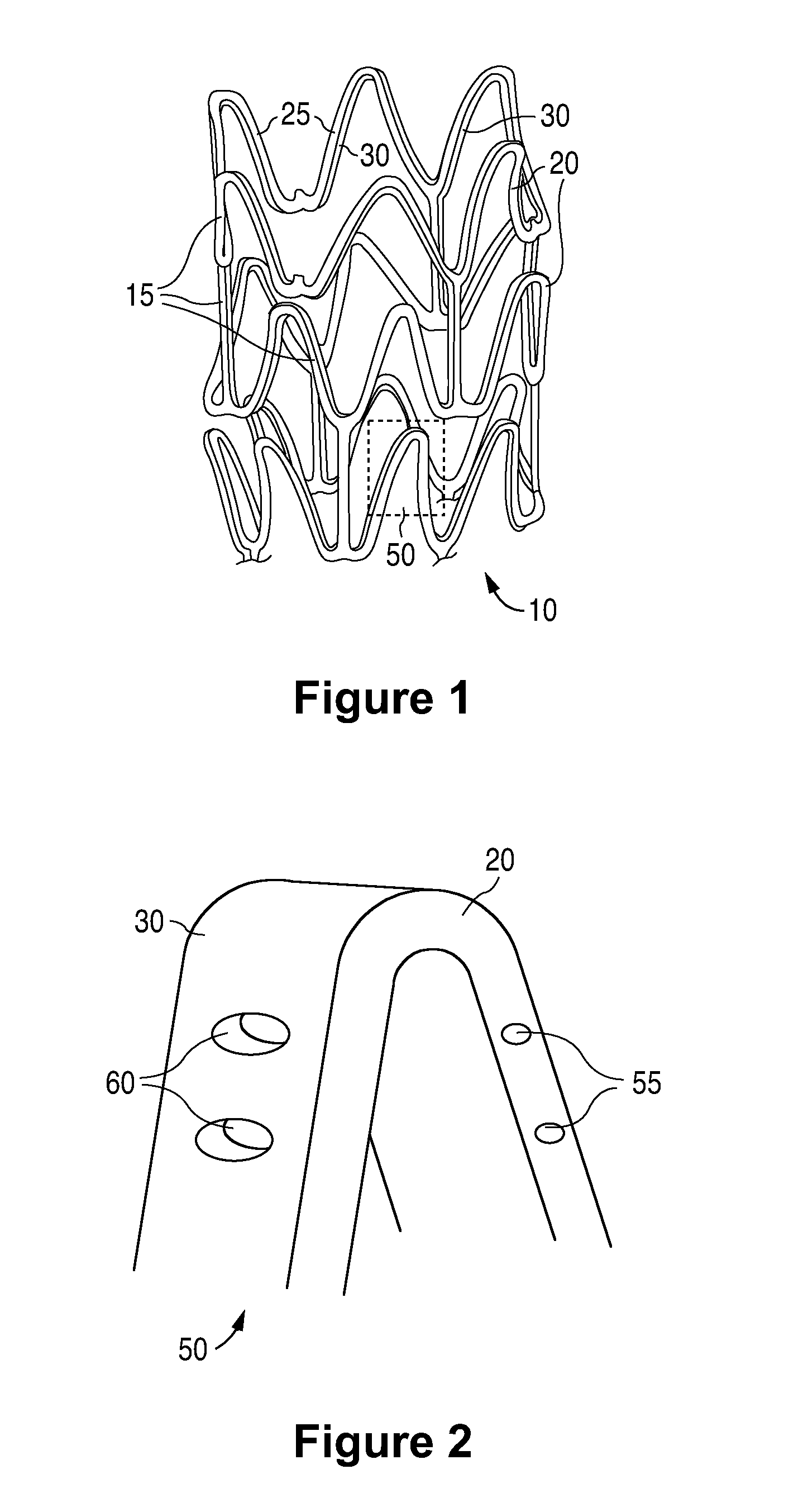 Anti-Proliferative And Anti-Inflammatory Agent Combination For Treatment Of Vascular Disorders With An Implantable Medical Device