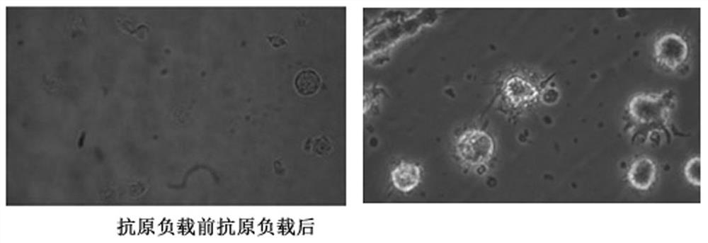 Preparation method of composite immune cell with high killing capability on tumor cells