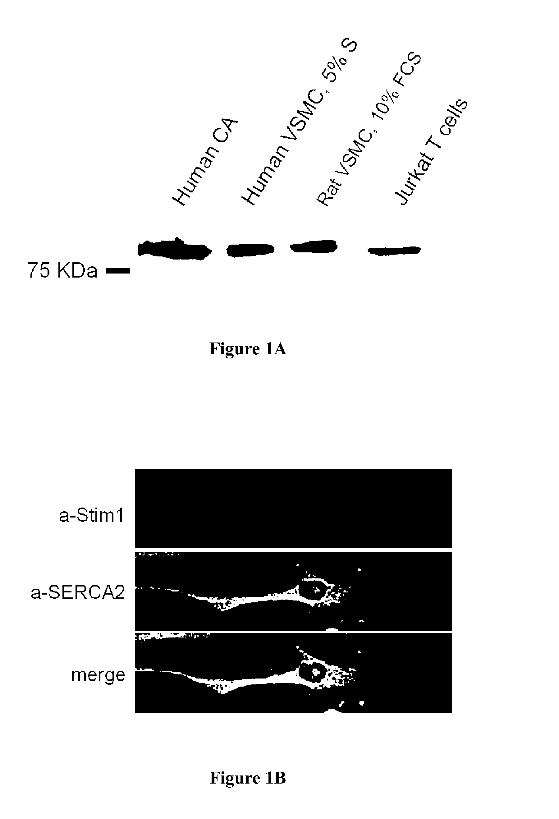 Inhibitors of stim1 for the treatment of cardiovascular disorders