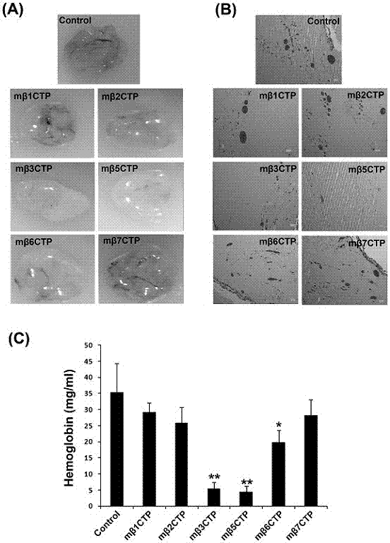 Application of integrin intracellular peptide sequences to inhibiting neovascularization