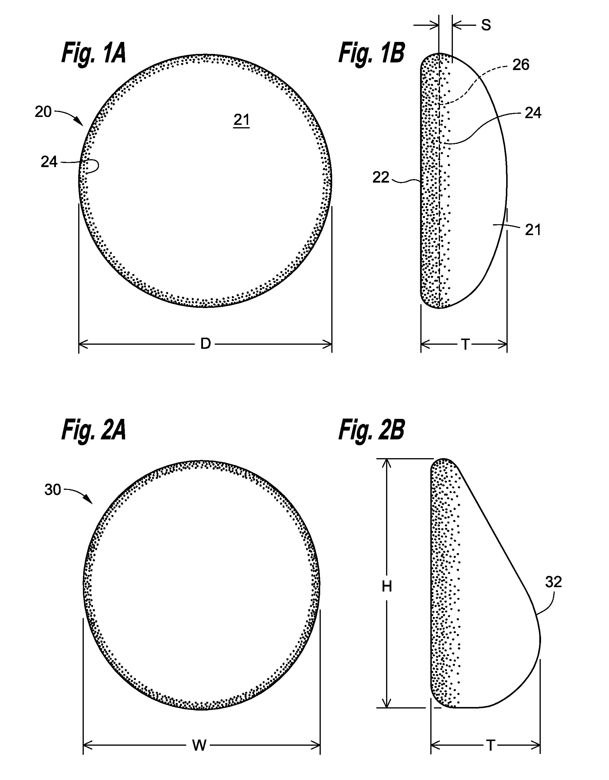 Soft filled prosthesis shell with discrete fixation surfaces