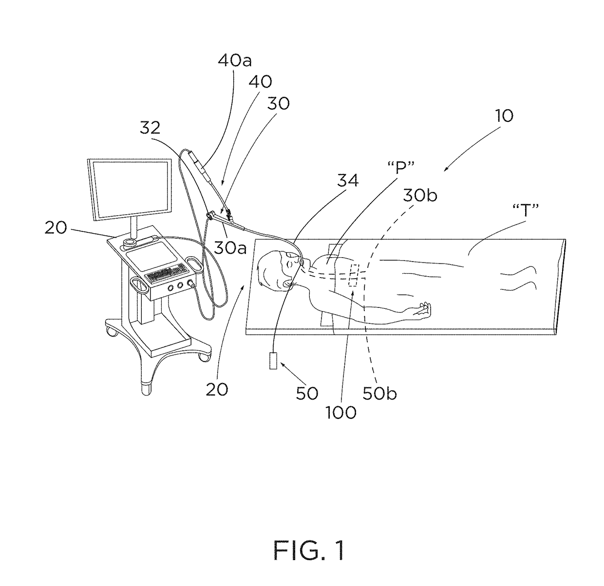 Bronchoscopy systems and coupling devices thereof