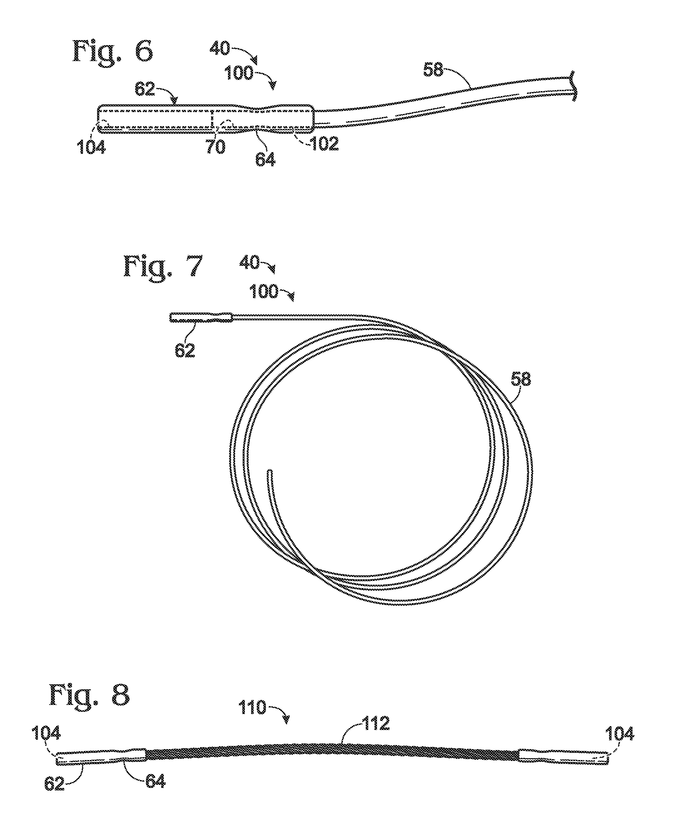Replacement system for a surgical wire