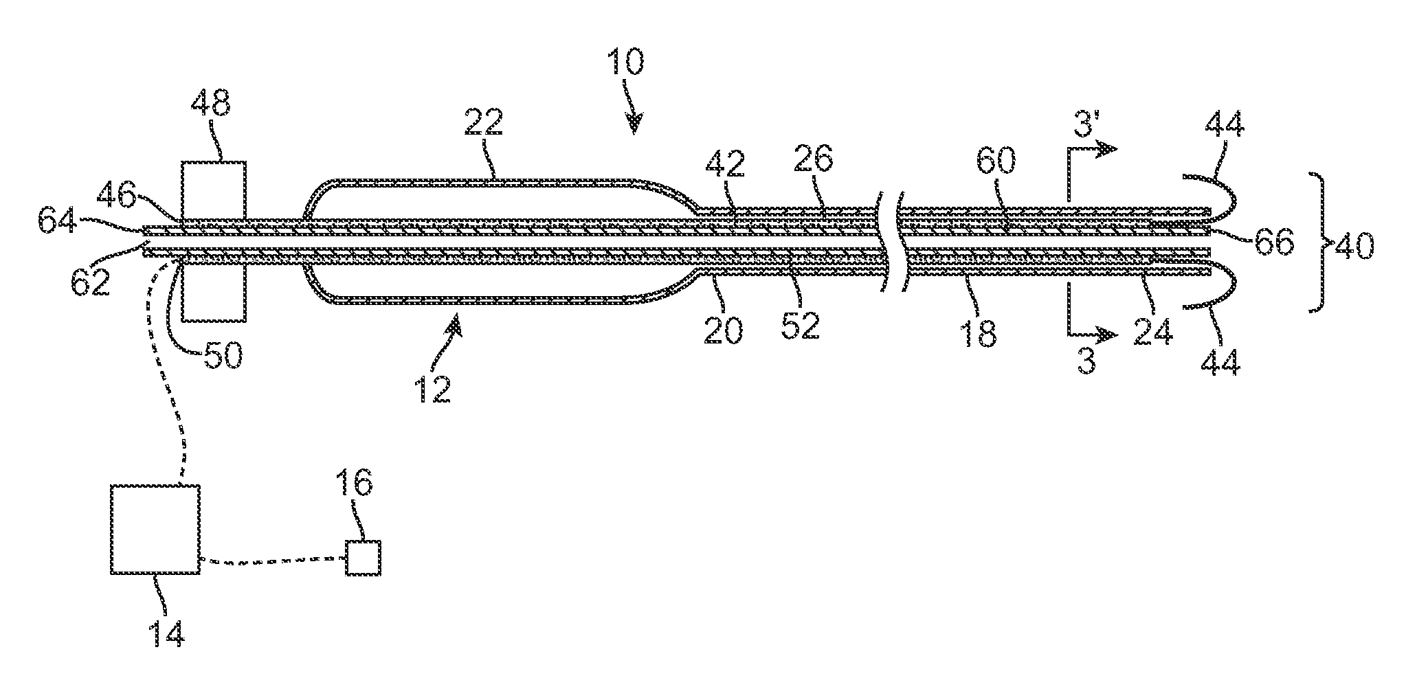 Radiofrequency ablation device
