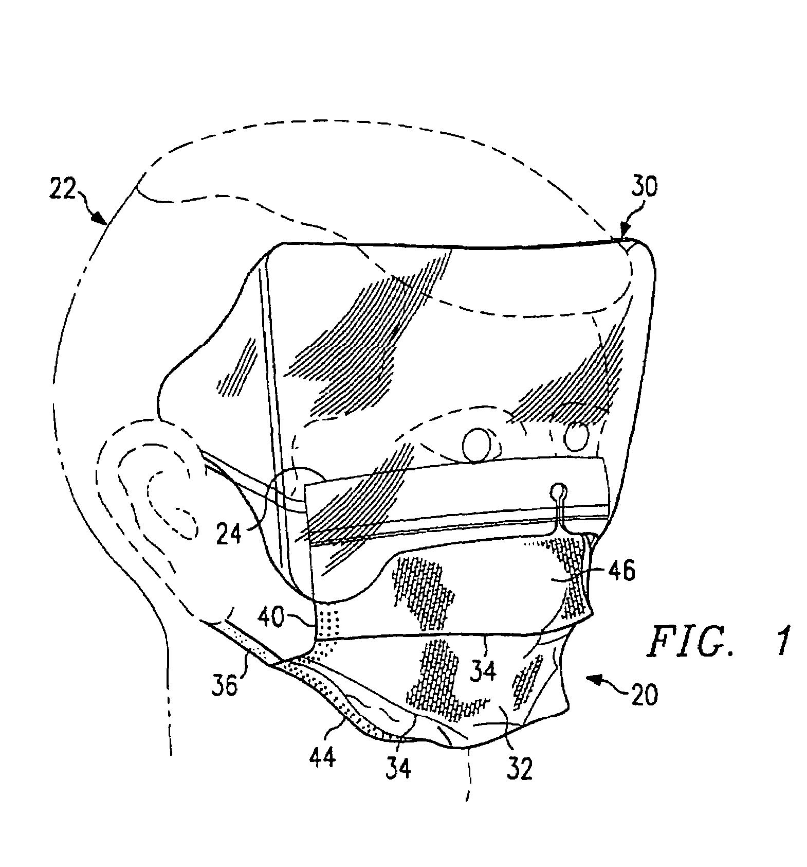 Facemasks containing an anti-fog / anti-glare composition