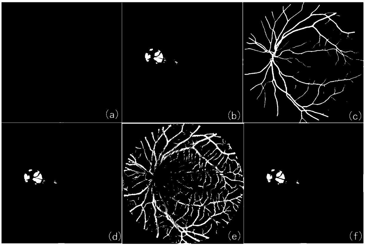 A method for locating fovea based on color retinal fundus image of lesion focus