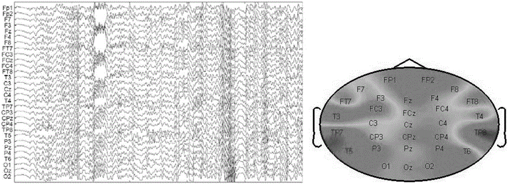 Wearable epilepsy brain-electricity seizure brain area positioning device and method