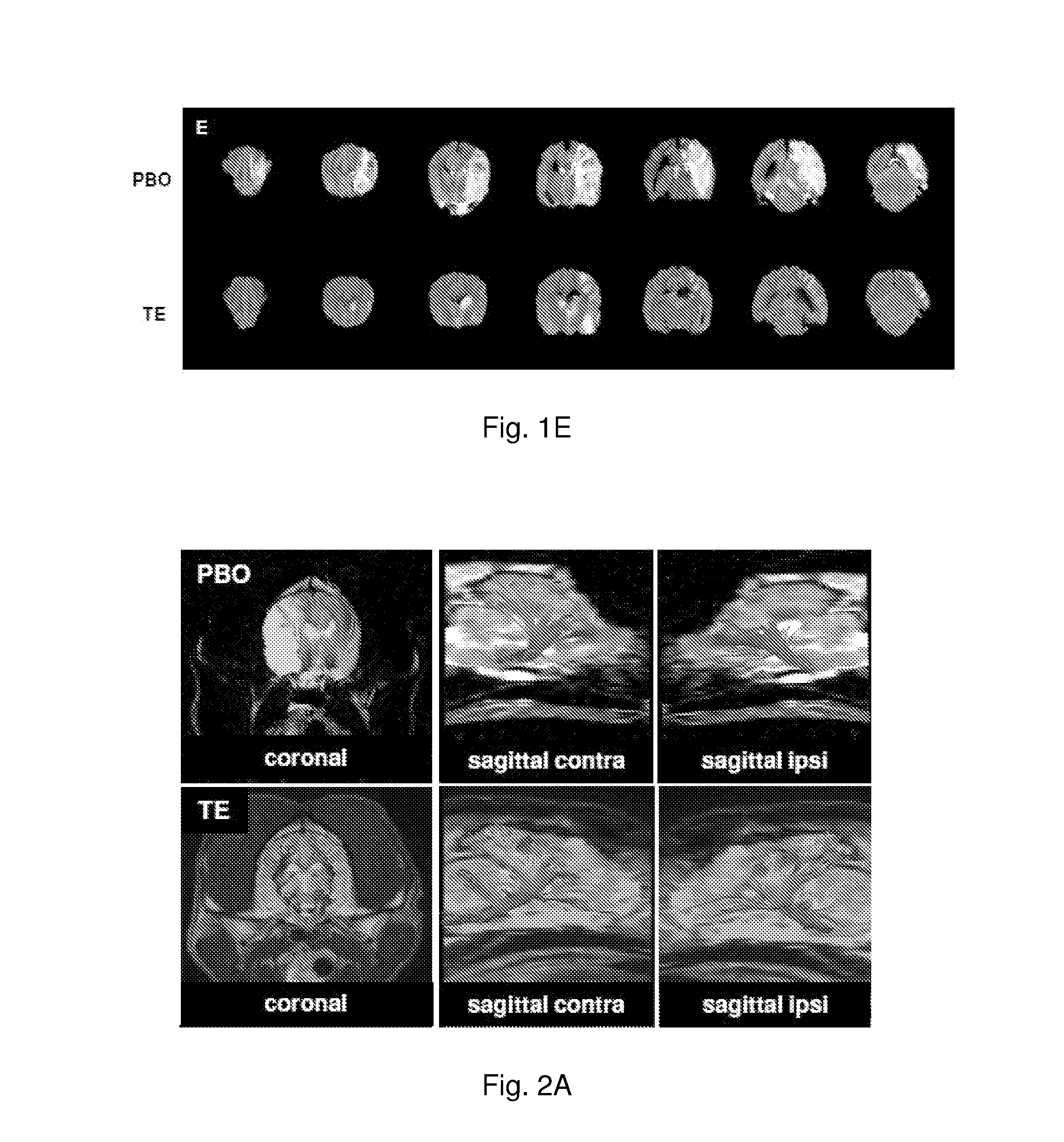 Methods and Compositions for Improving Pial Collateral Circulation and Treating Blood Clotting Disorders