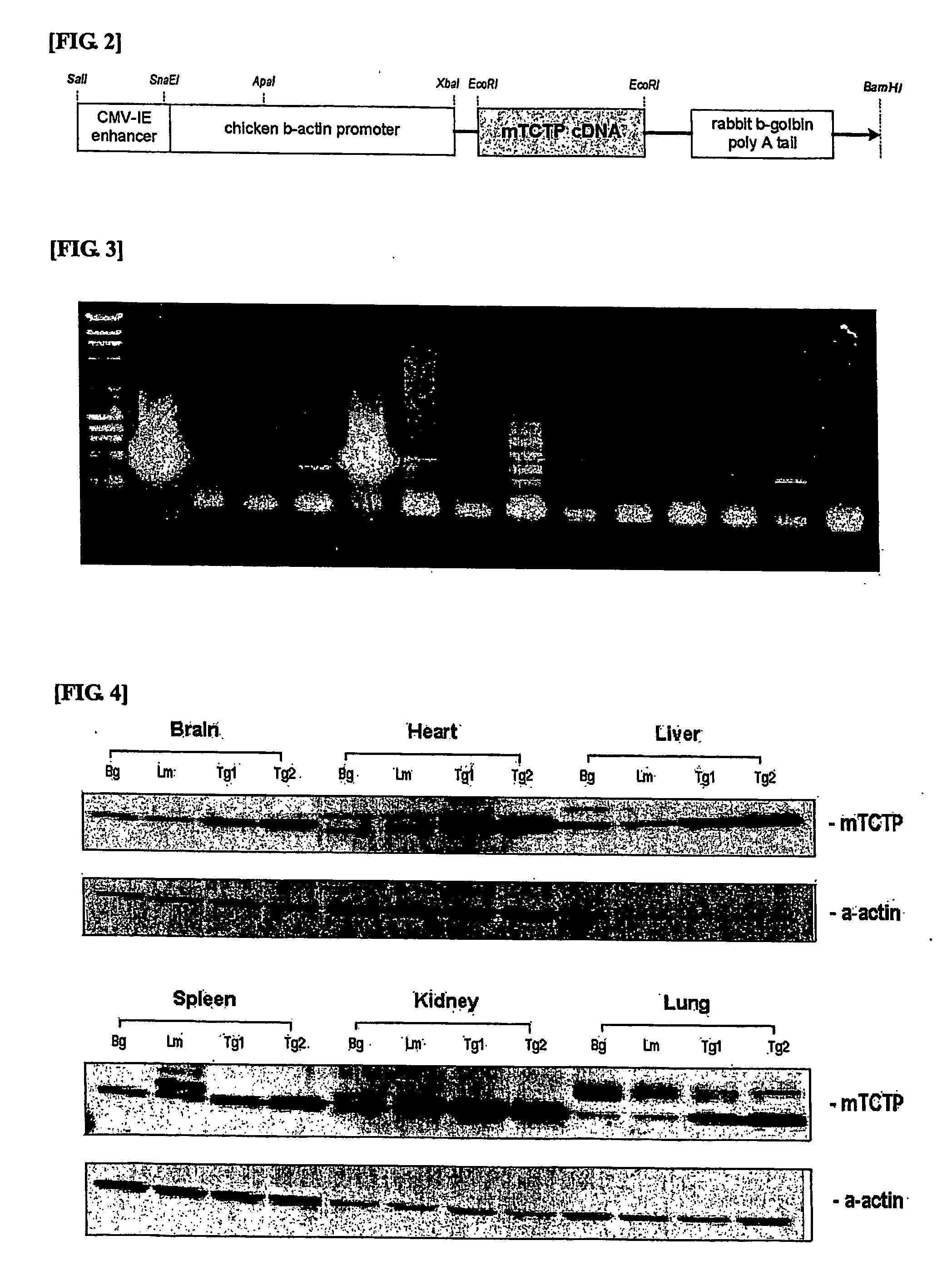 Composition For Screening Anti-Hypertension Drug Comprising Mammal Tctp Gene or Its Protein Product, and Method For Screening Anti-Hypertension Drug Using Said Composition