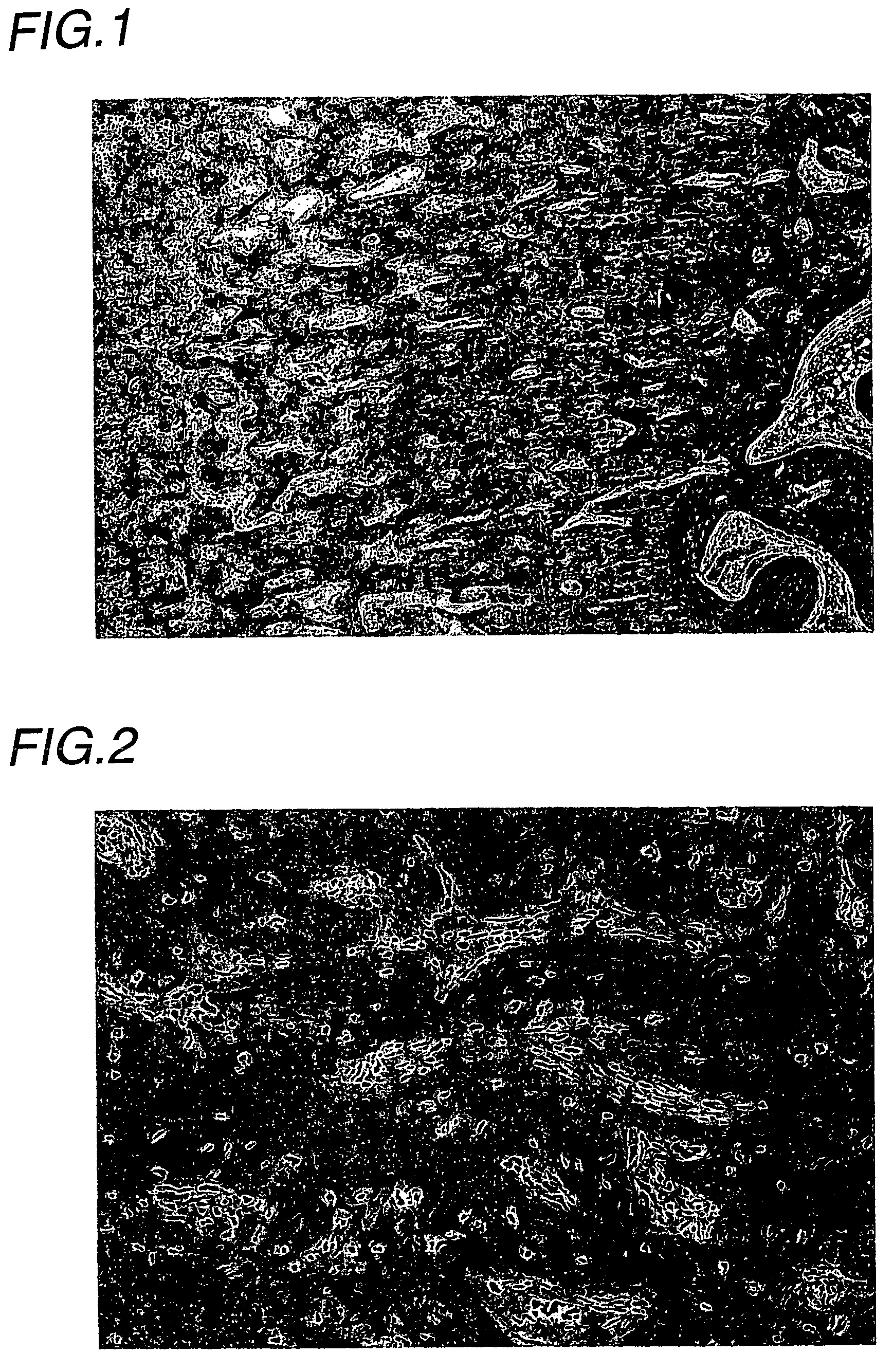 Agent for treatment of metabolic bone disease
